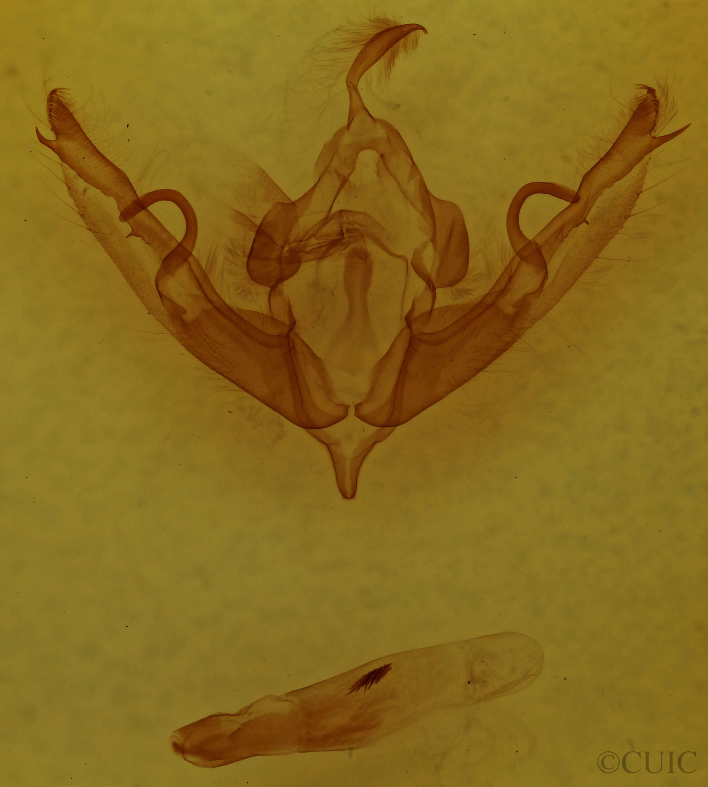 genitalia view of adult Lithophane petulca