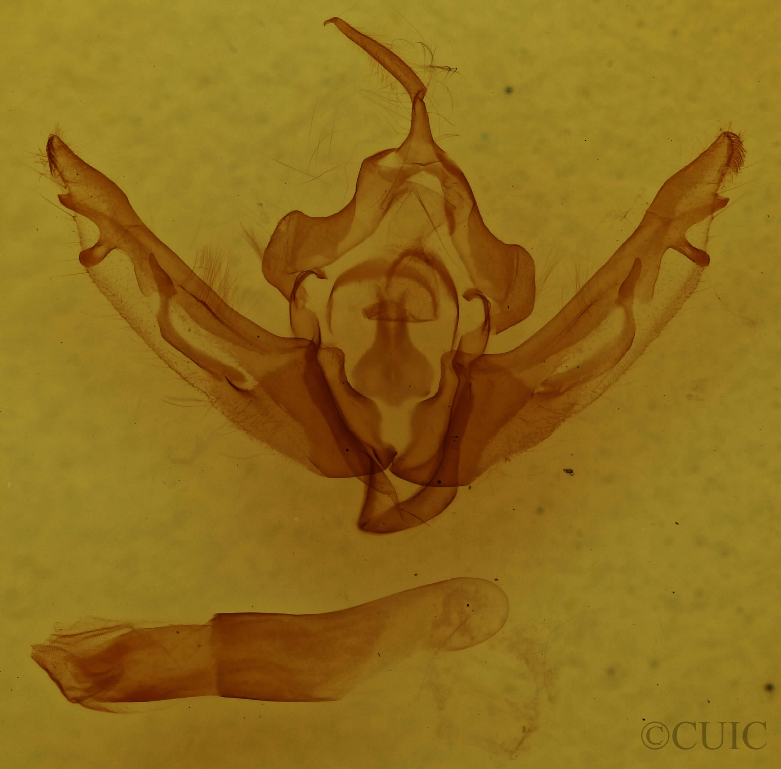 genitalia view of adult Lithophane pexata