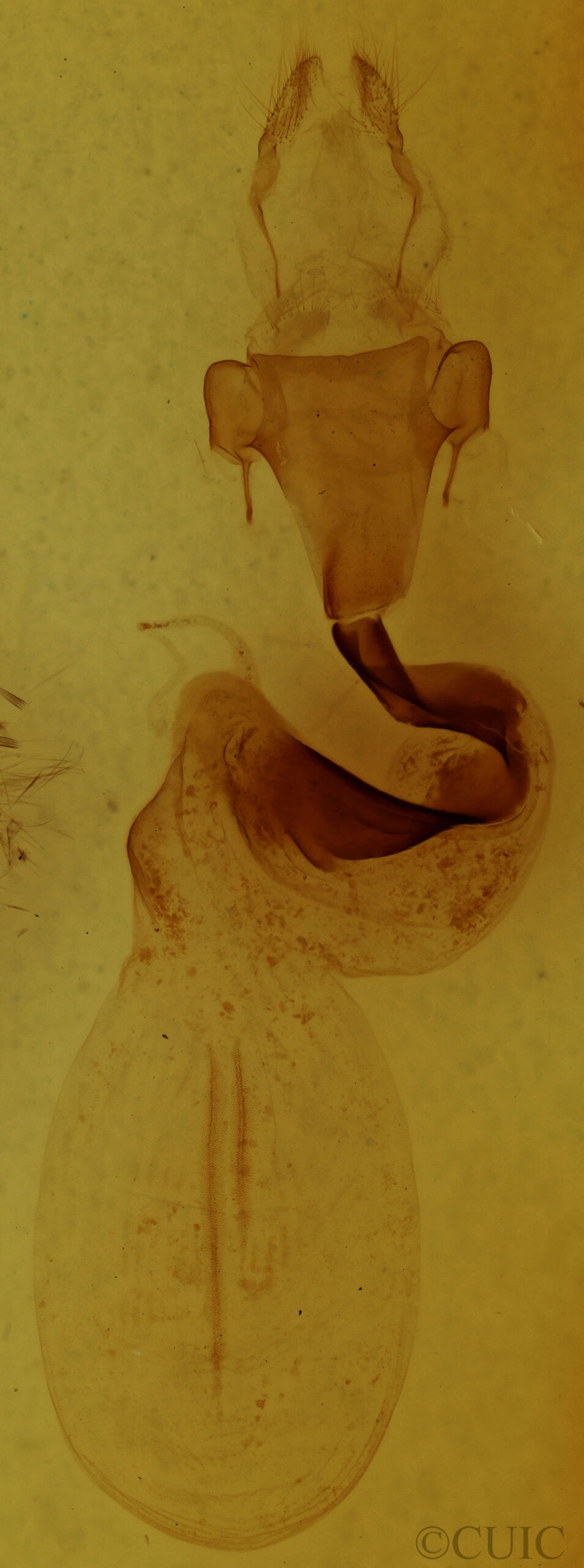 genitalia view of adult Lithophane querquera
