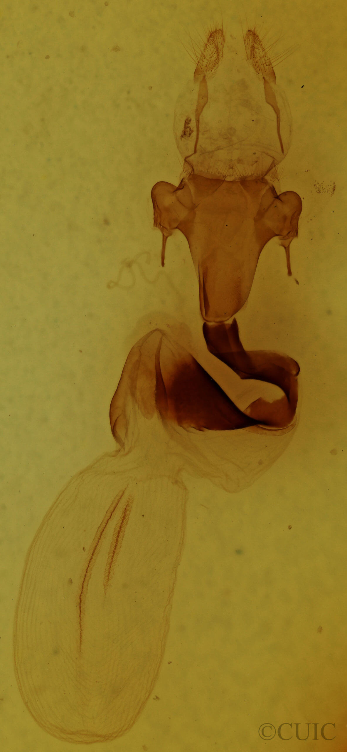 genitalia view of adult Lithophane querquera