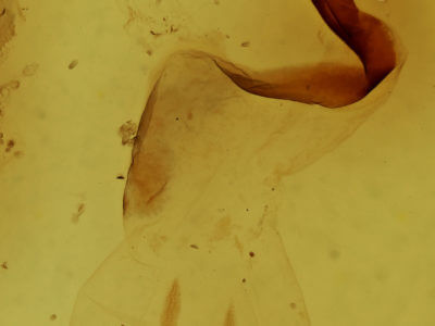 genitalia view of adult Lithophane tepida