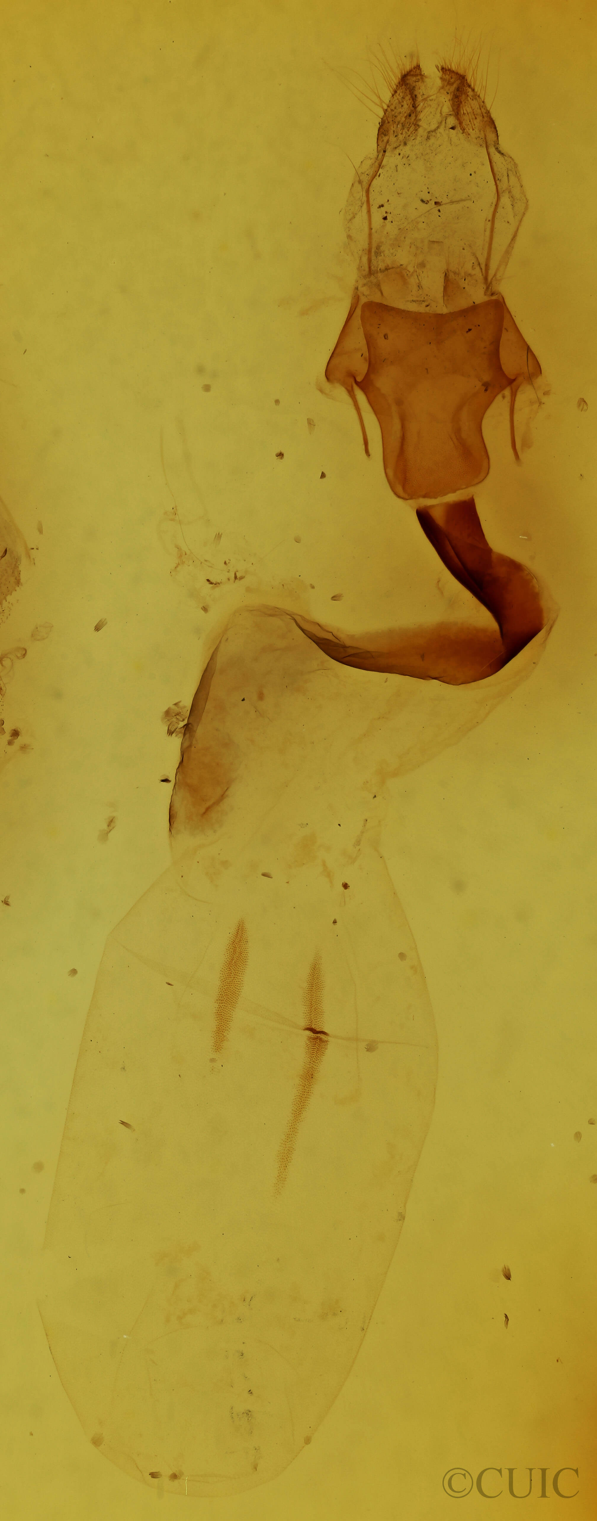 genitalia view of adult Lithophane tepida