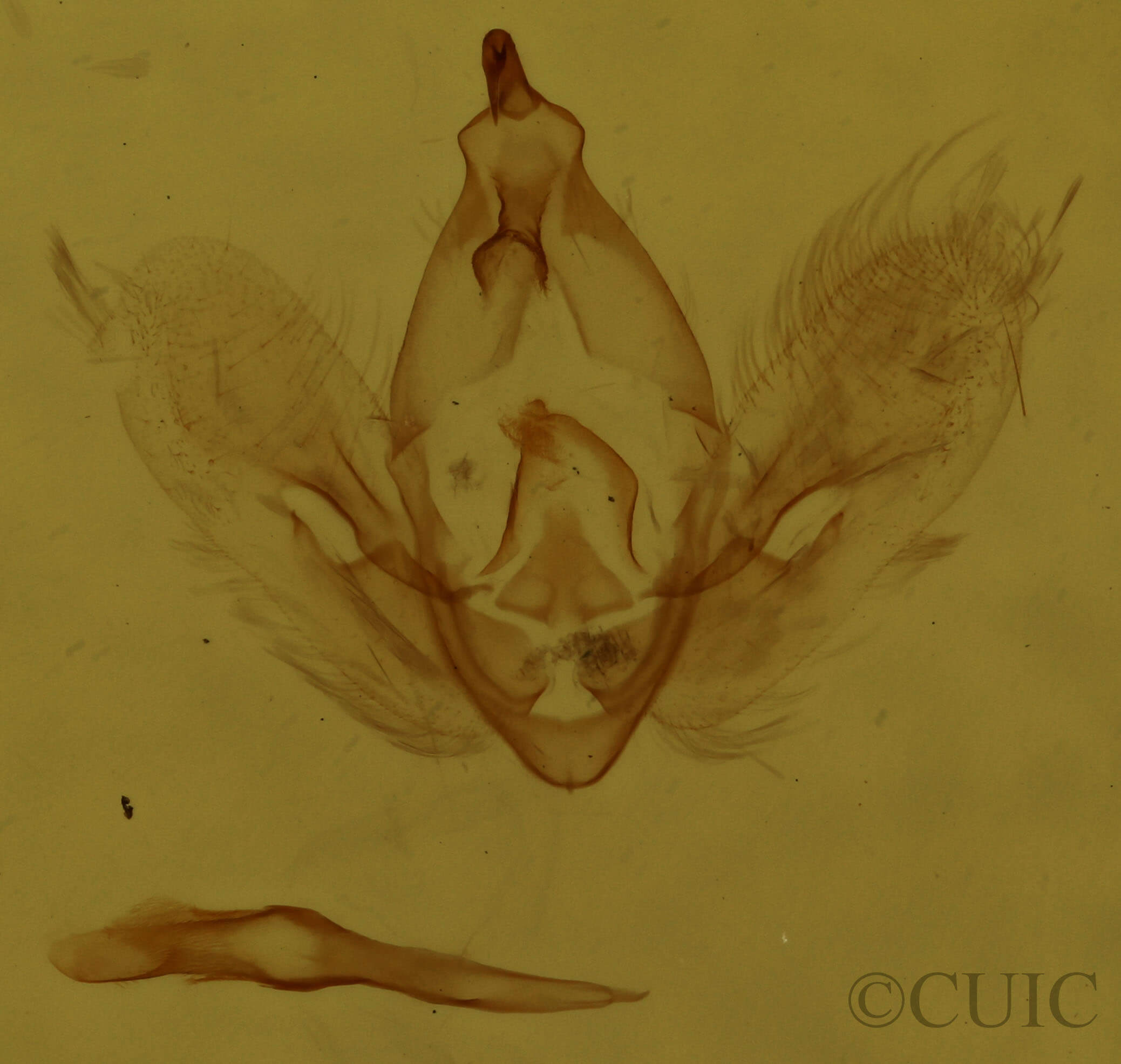 genitalia view of adult Hypena eductalis
