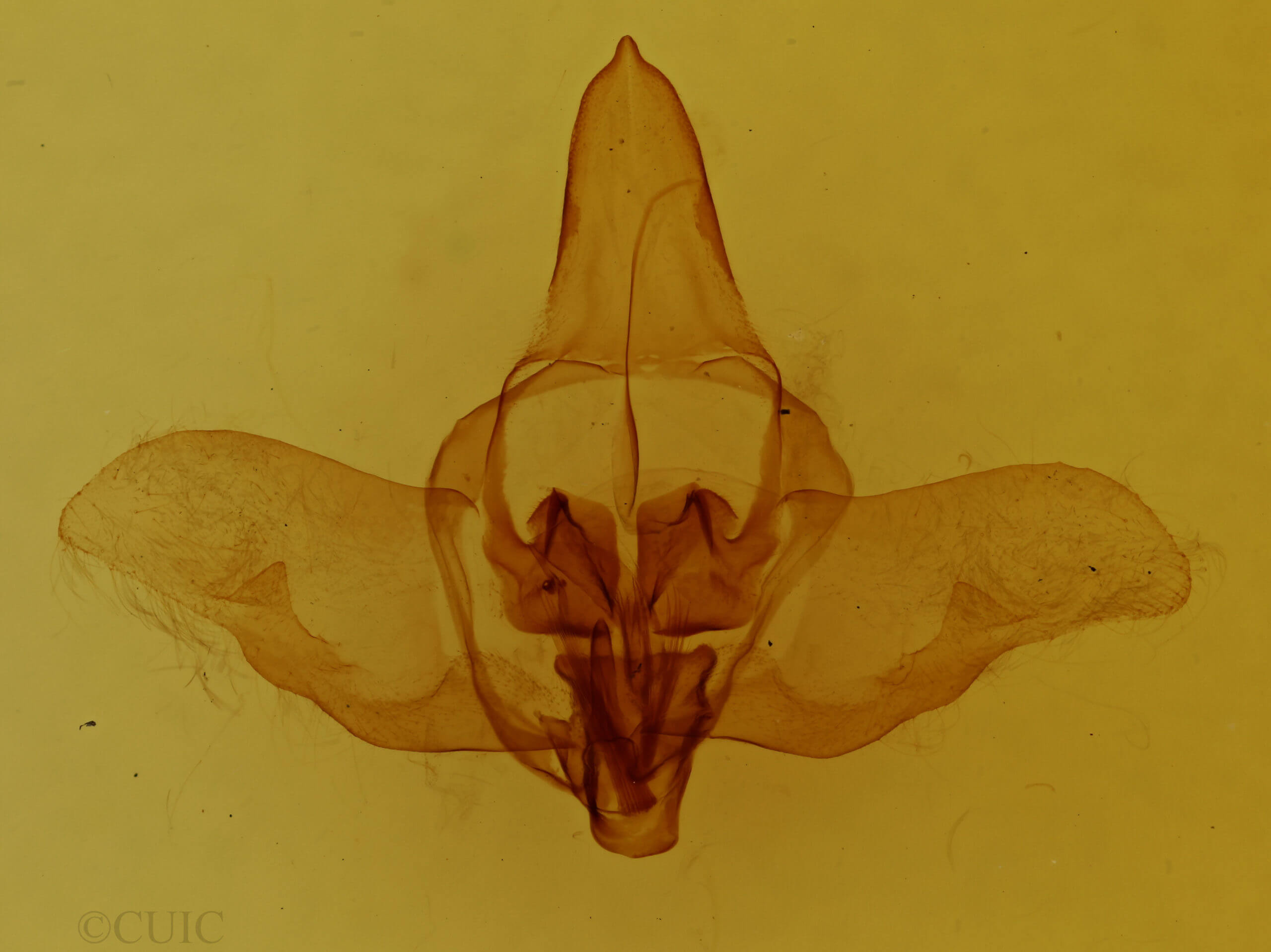 genitalia view of adult Macessoga fabia