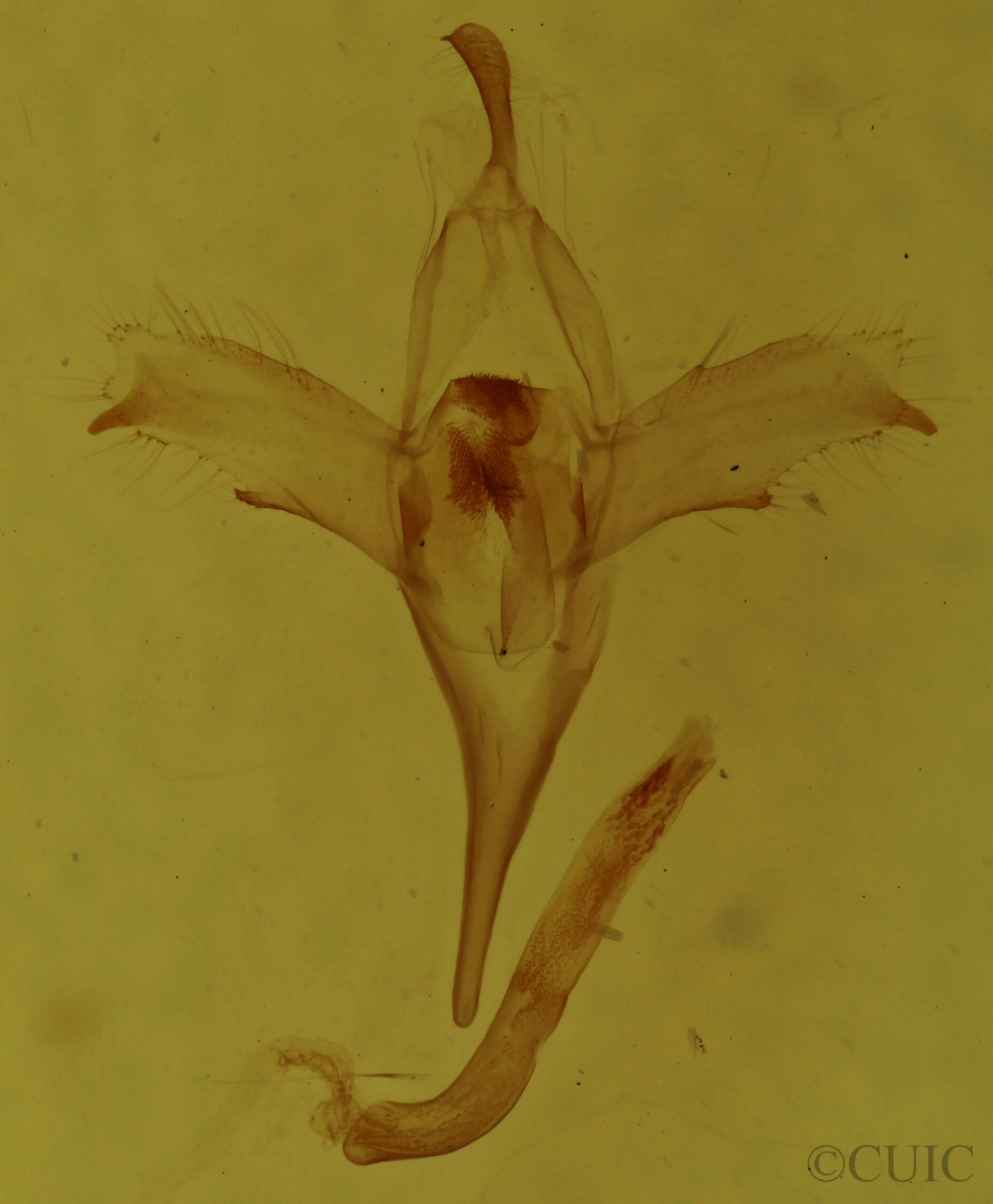 genitalia view of adult Macrochilo orciferalis