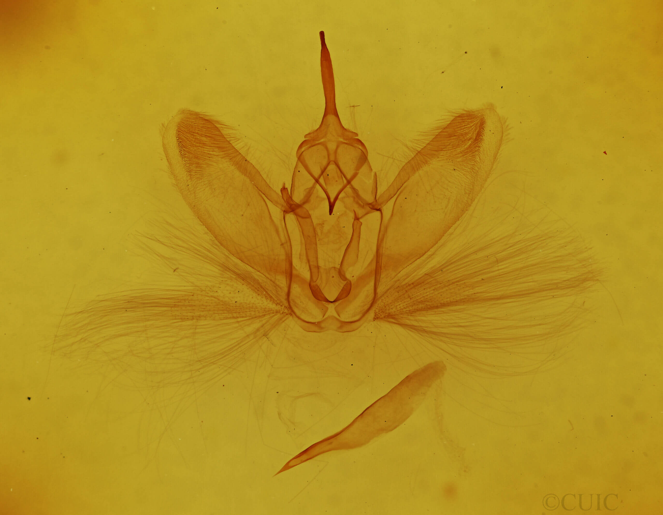 genitalia view of adult Metarranthis angularia