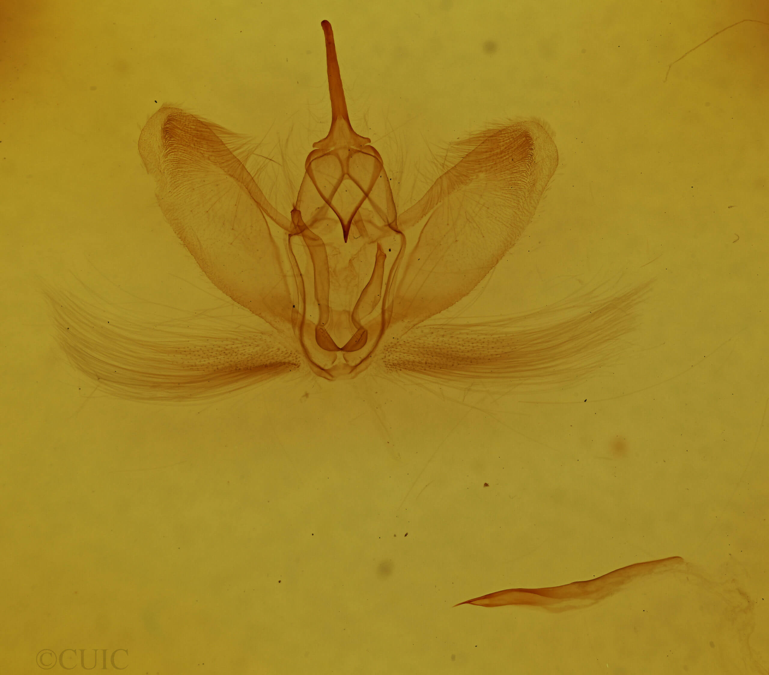 genitalia view of adult Metarranthis angularia