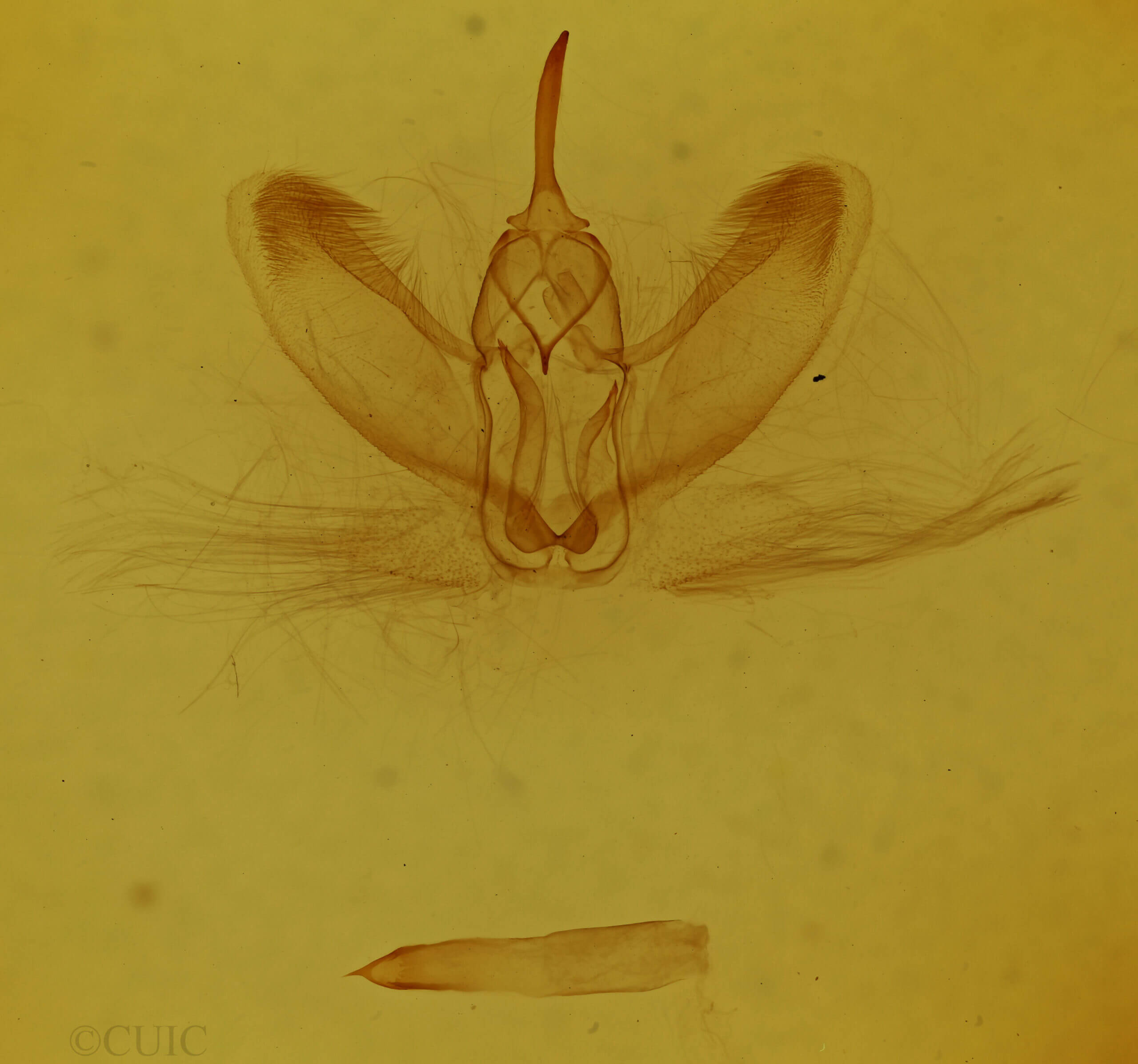genitalia view of adult Metarranthis duaria