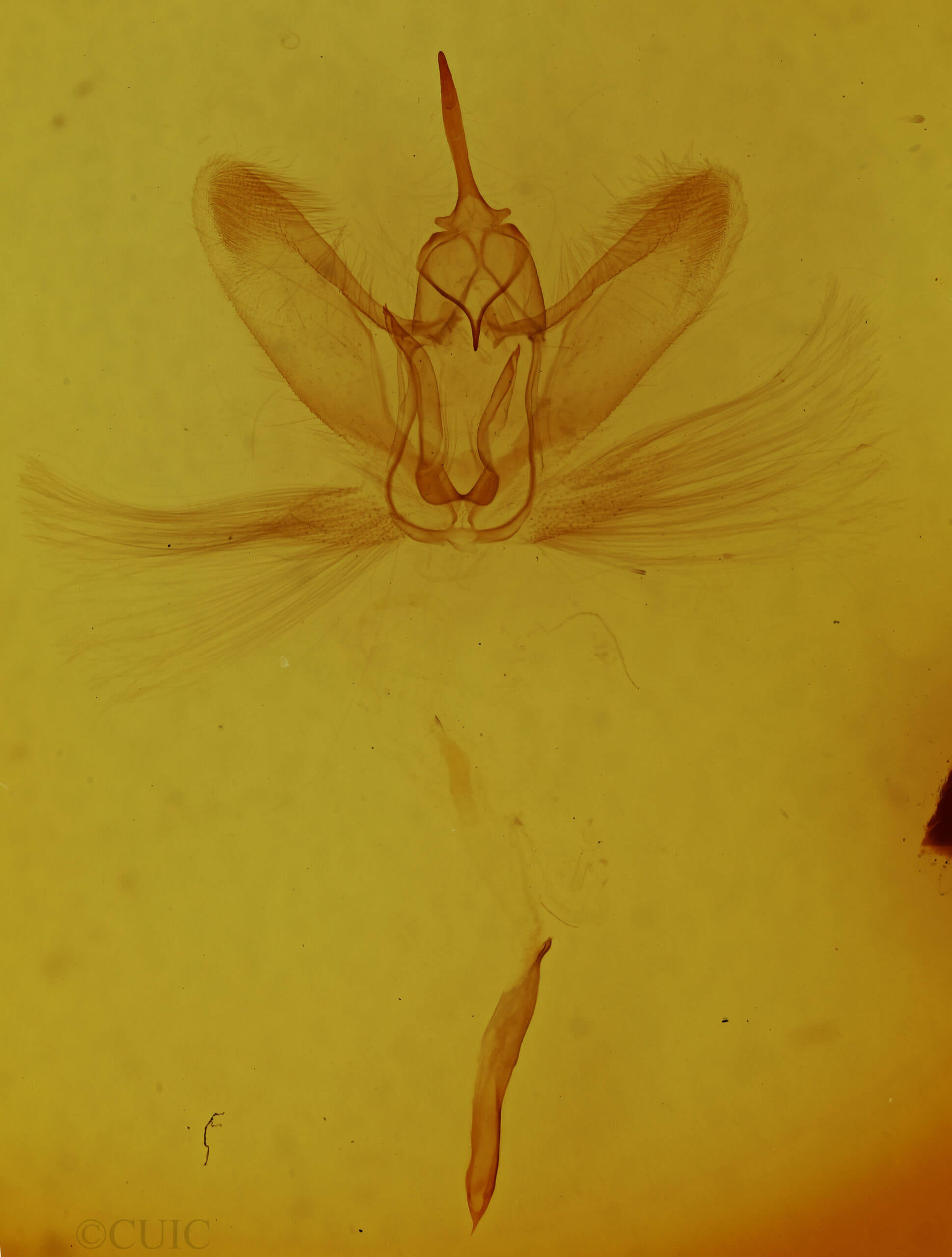 genitalia view of adult Metarranthis duaria