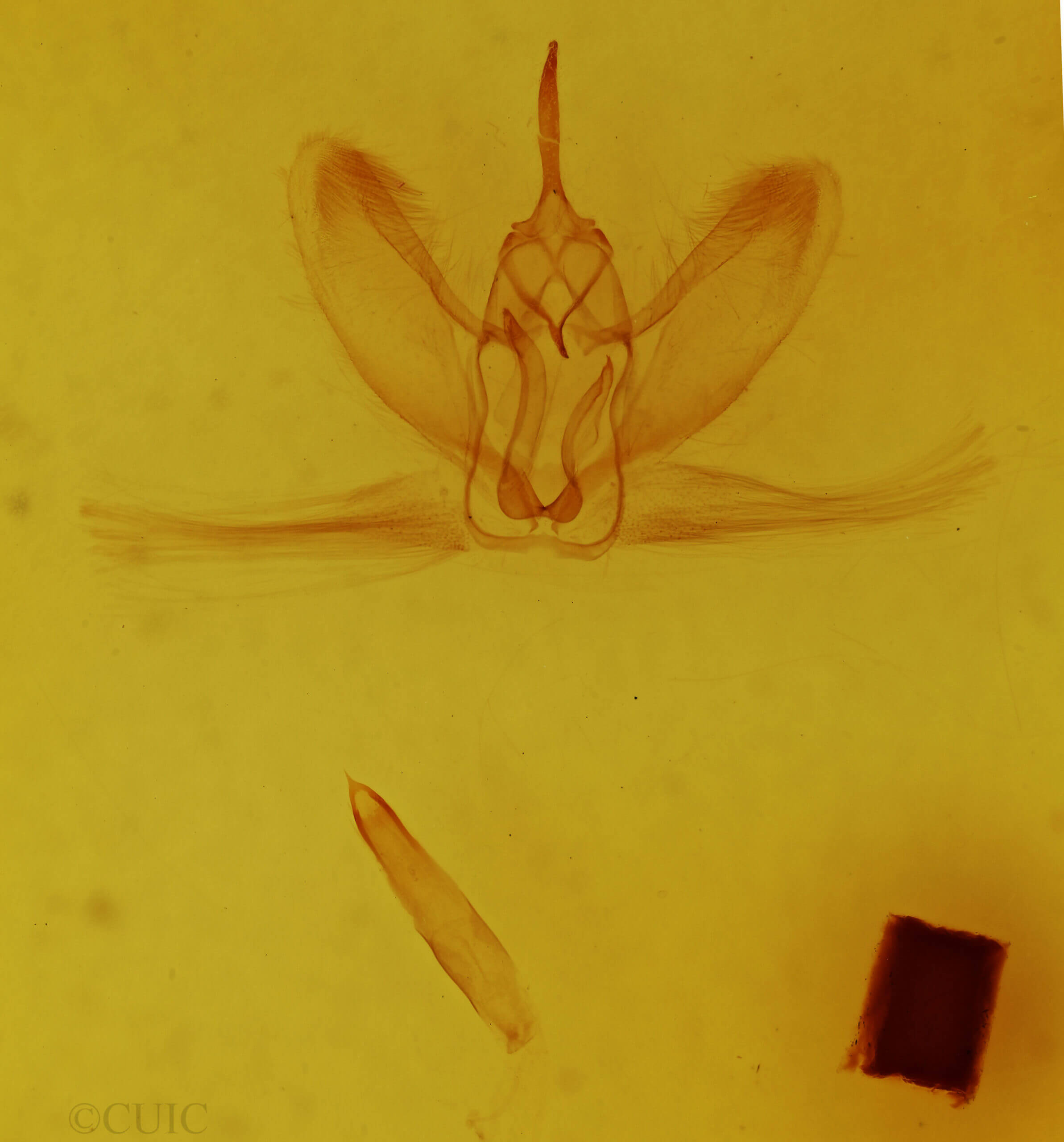 genitalia view of adult Metarranthis duaria