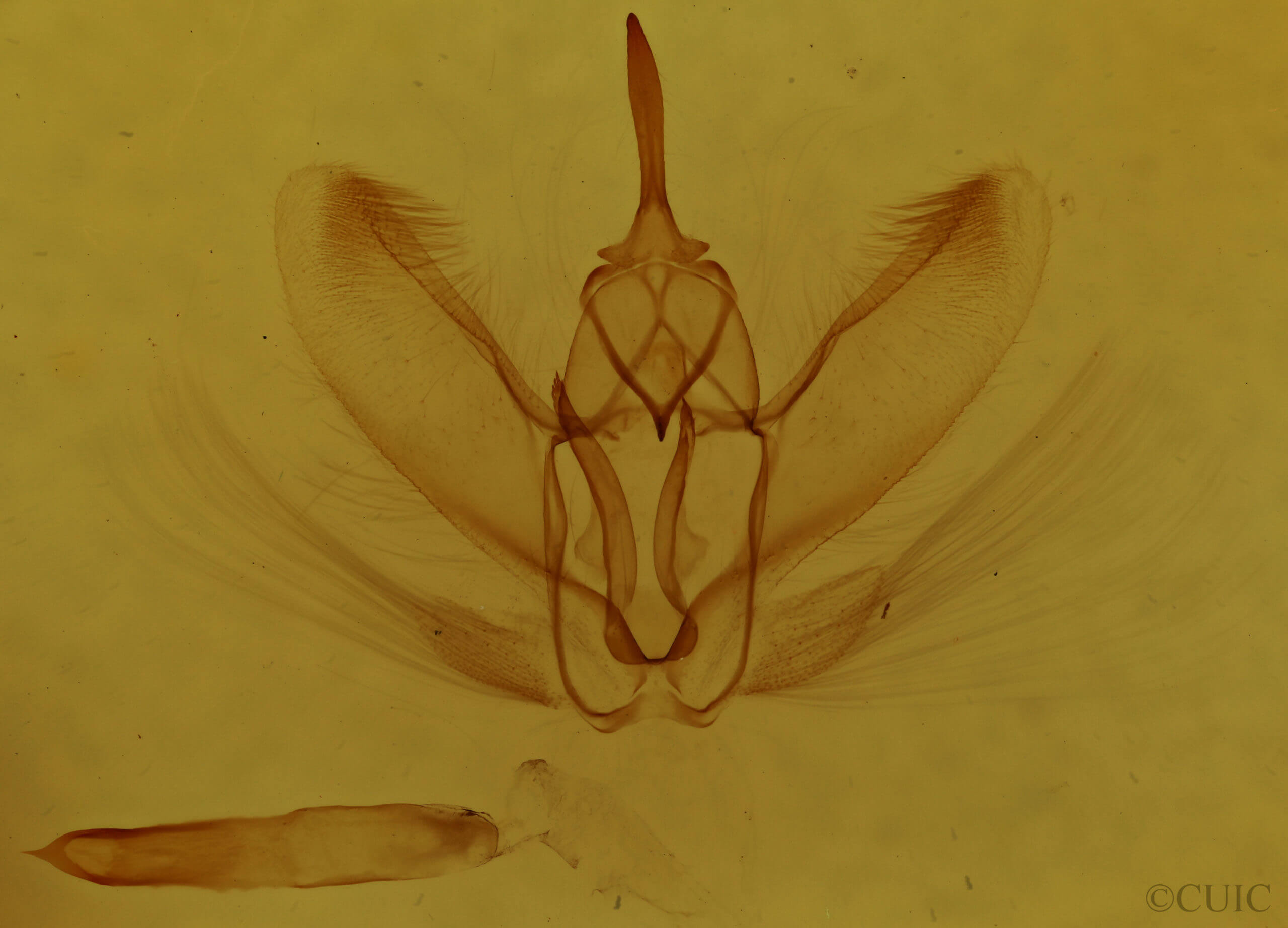 genitalia view of adult Metarranthis duaria