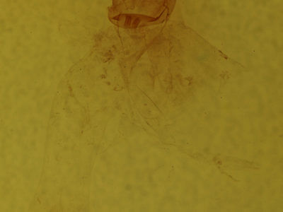 genitalia view of adult Metarranthis hypochraria