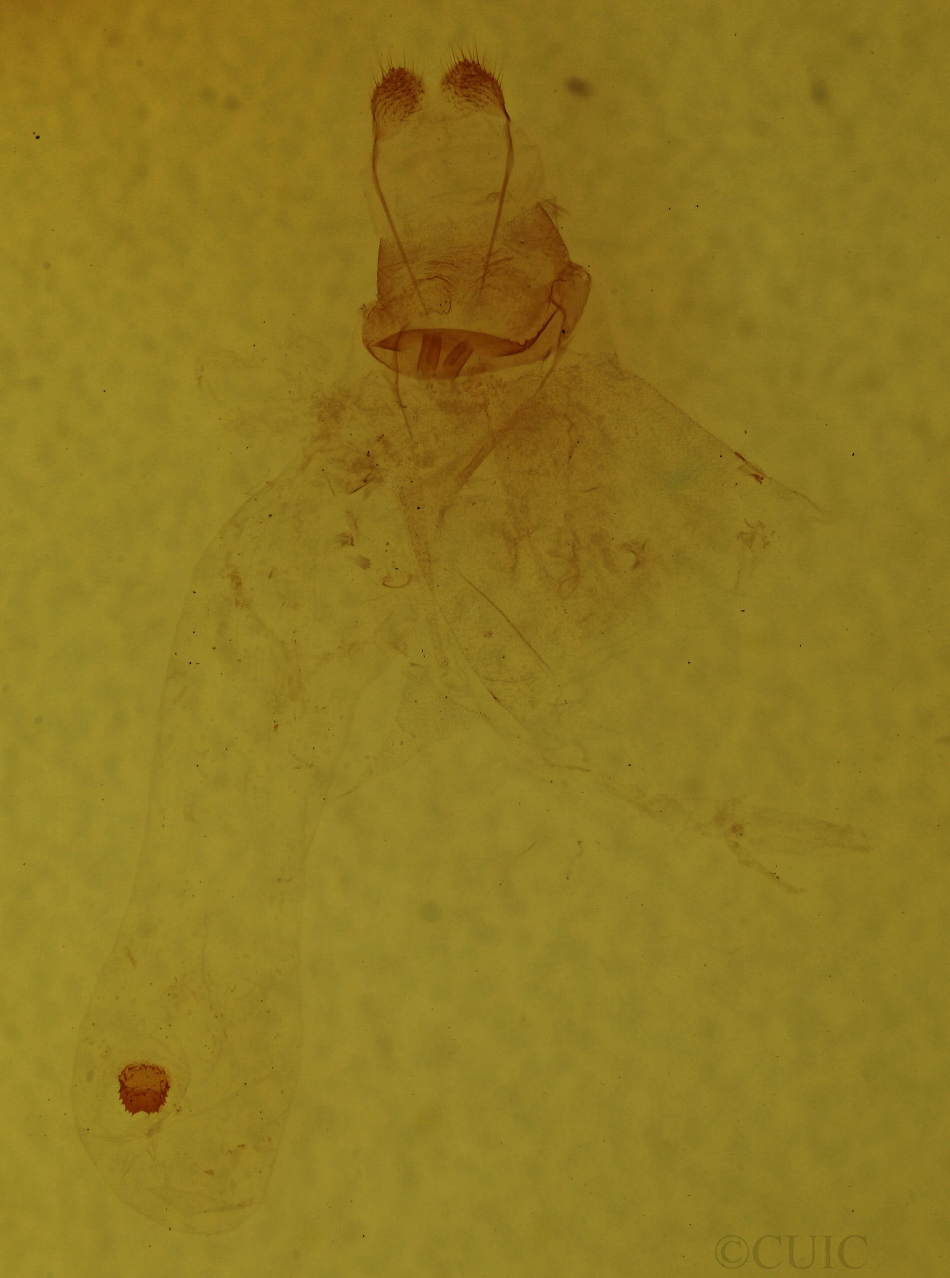 genitalia view of adult Metarranthis hypochraria