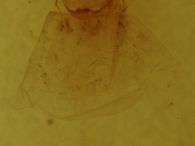 genitalia view of adult Metarranthis hypochraria