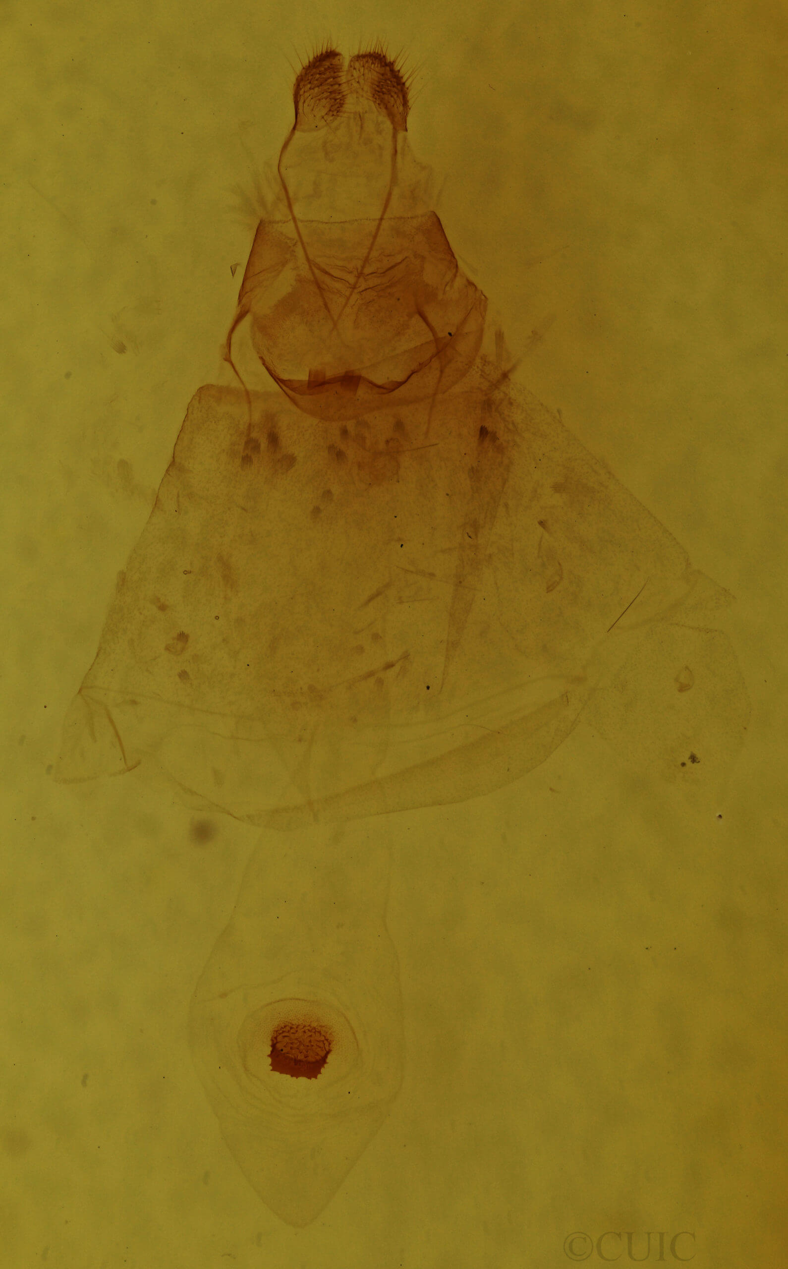 genitalia view of adult Metarranthis hypochraria