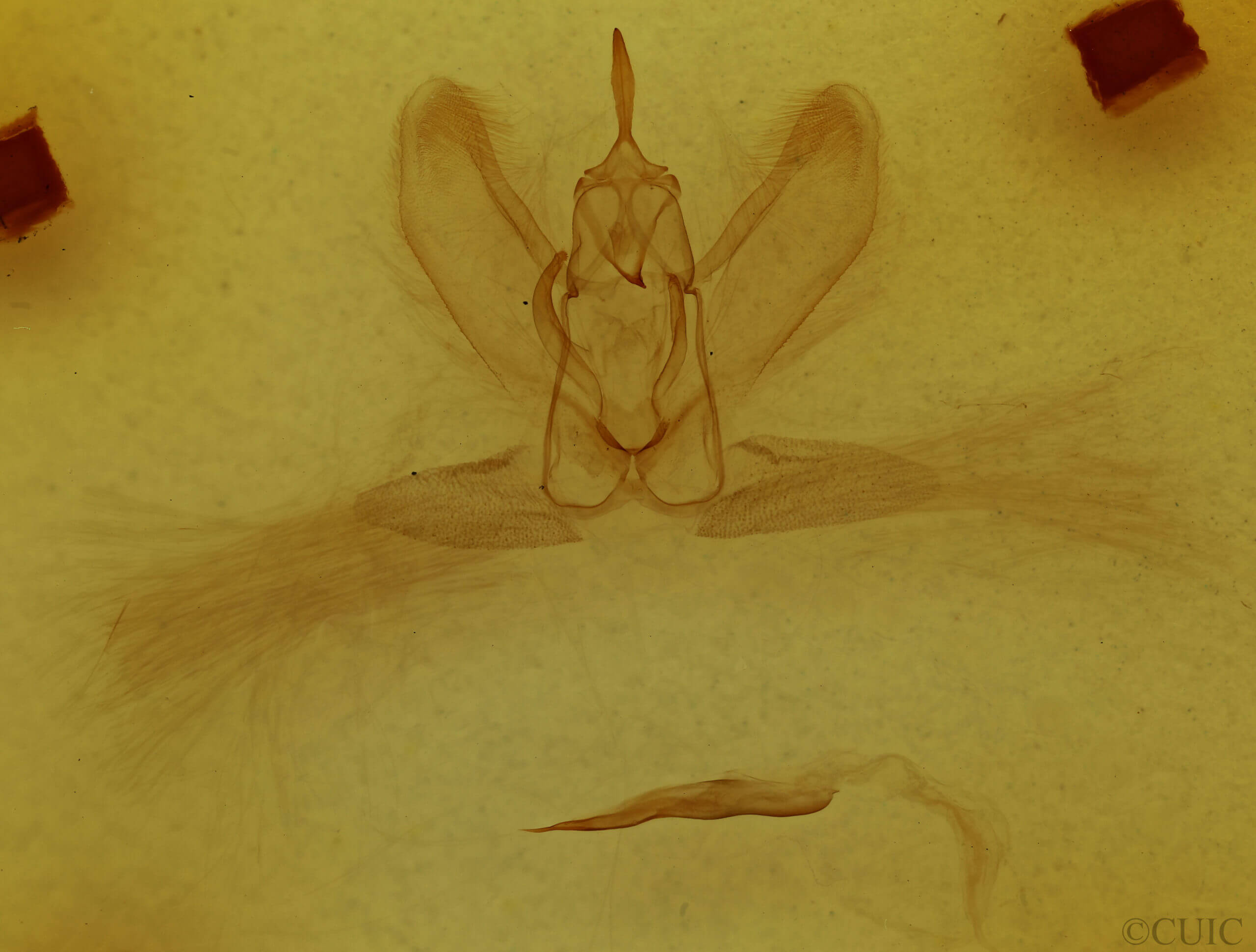 genitalia view of adult Metarranthis hypochraria