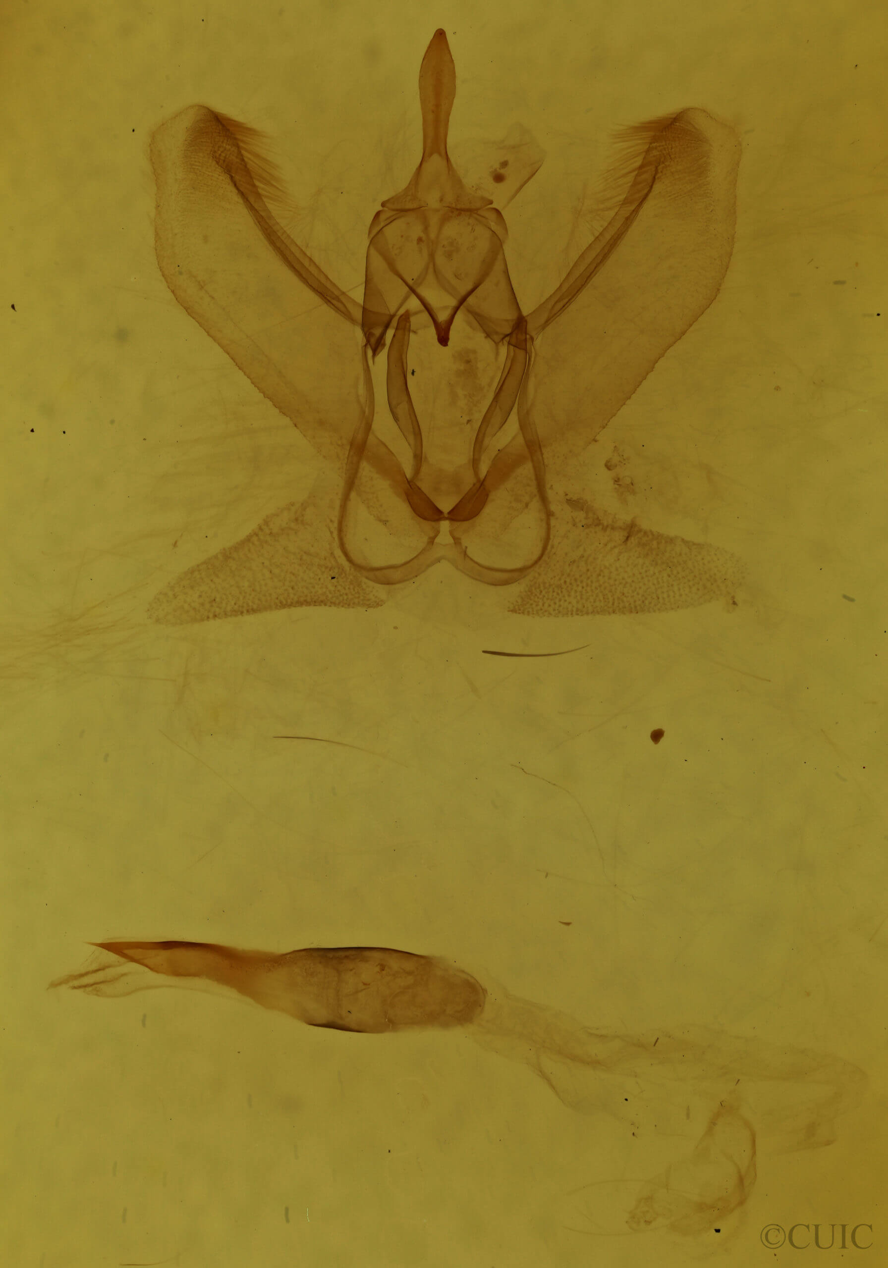 genitalia view of adult Metarranthis indeclinata
