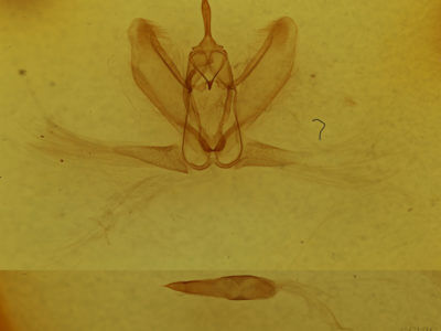 genitalia view of adult Metarranthis indeclinata