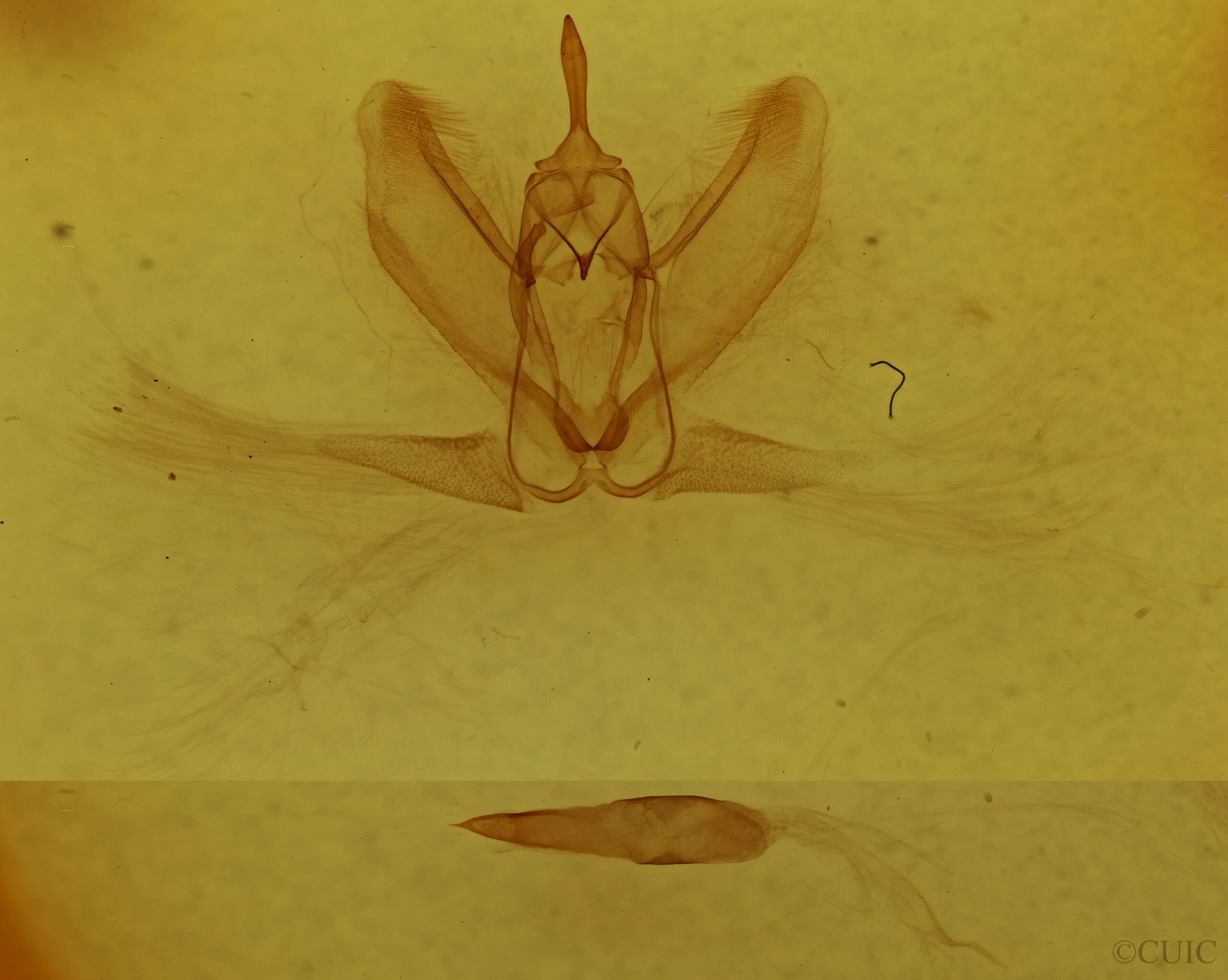 genitalia view of adult Metarranthis indeclinata