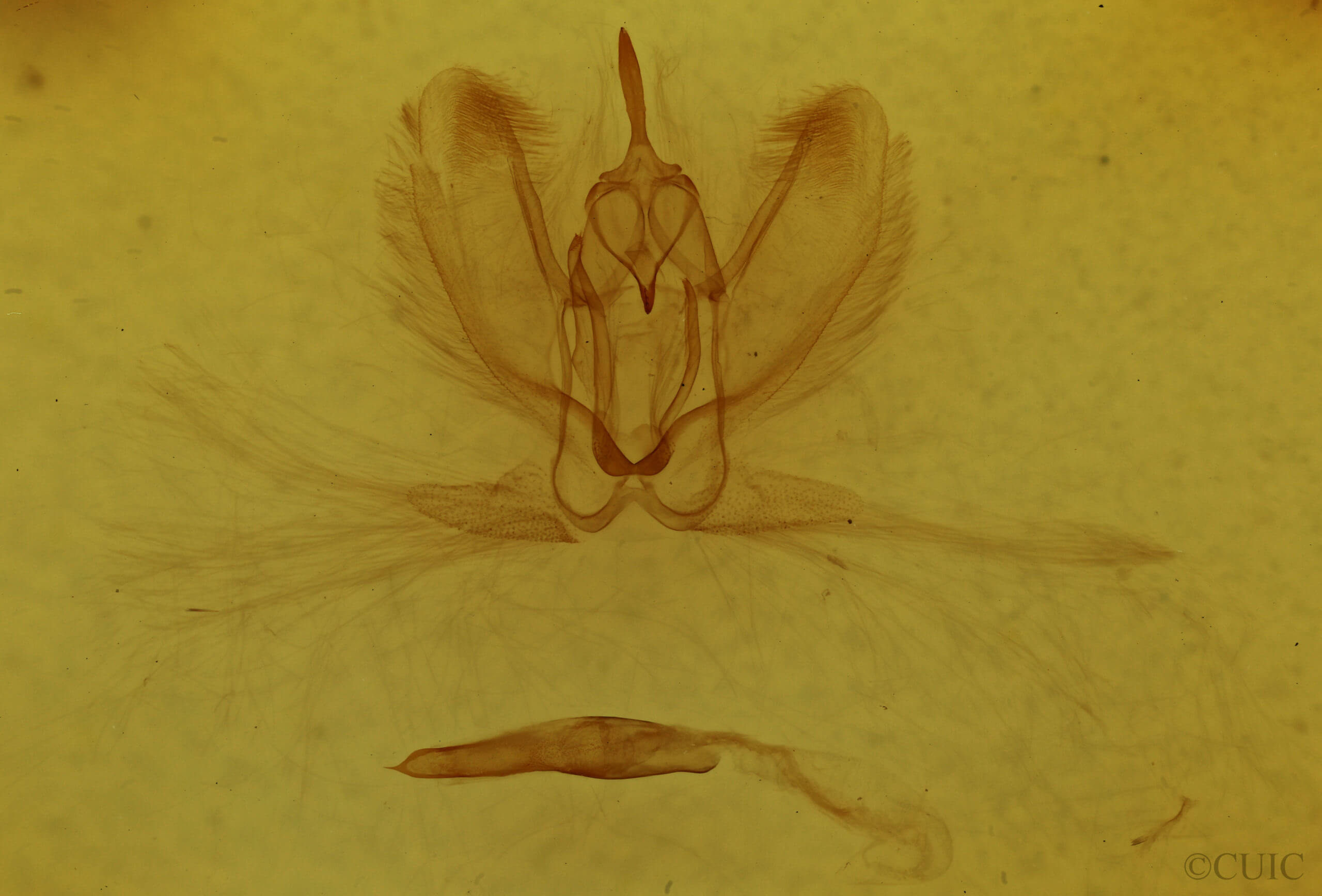 genitalia view of adult Metarranthis refractaria