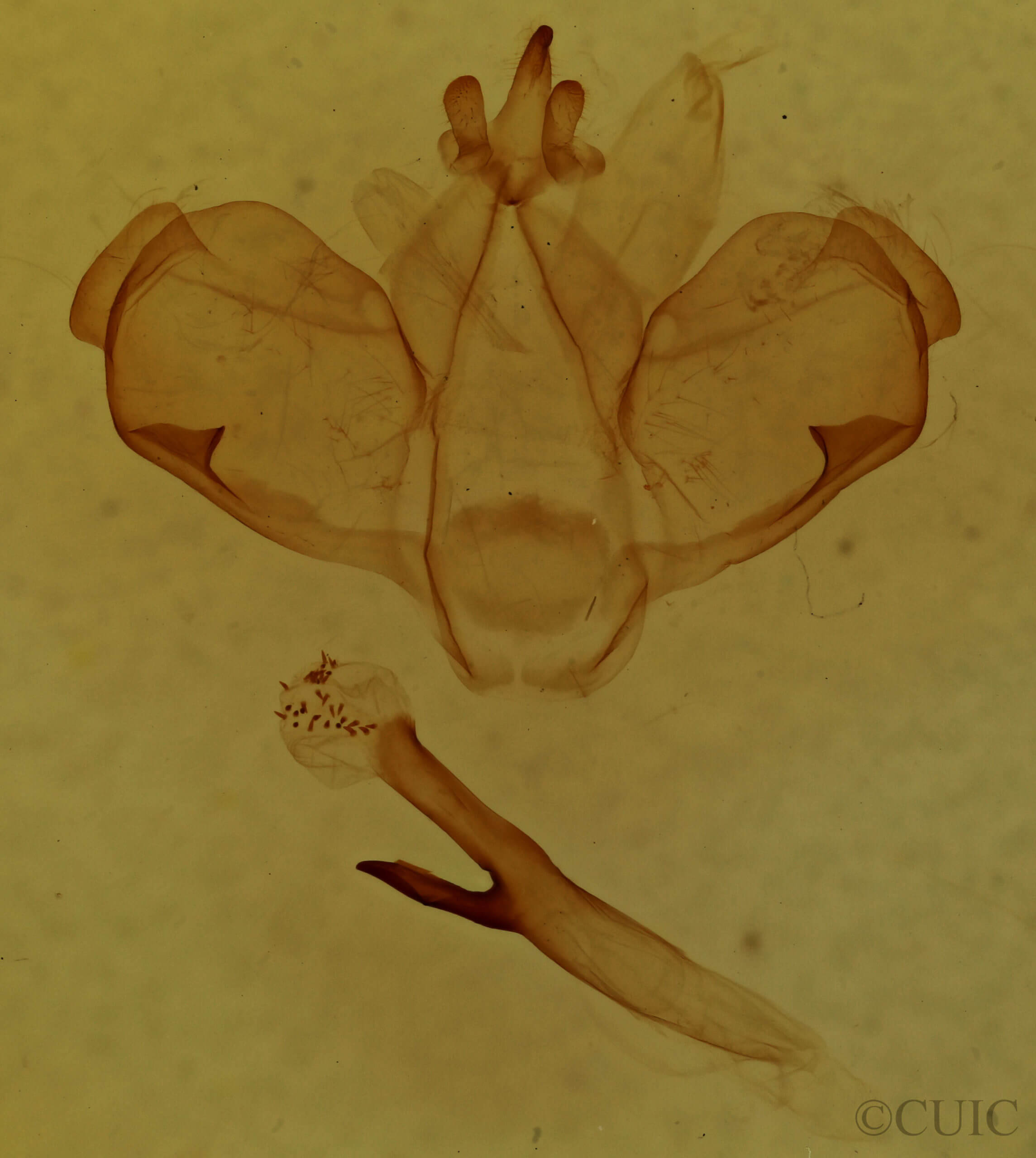genitalia view of adult Microphalera grisea