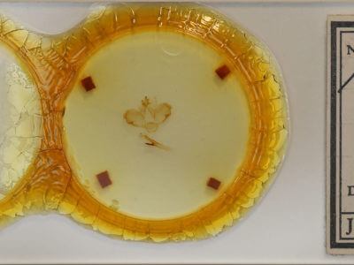 slide view of adult Microphalera grisea