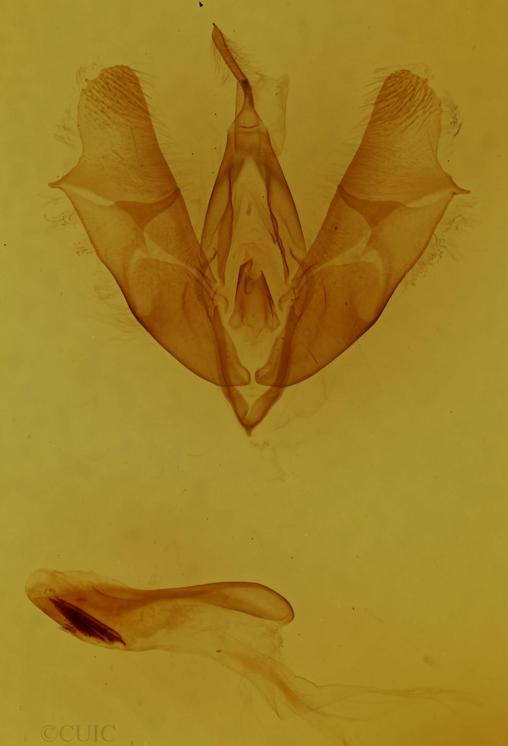 genitalia view of adult Moma alpium