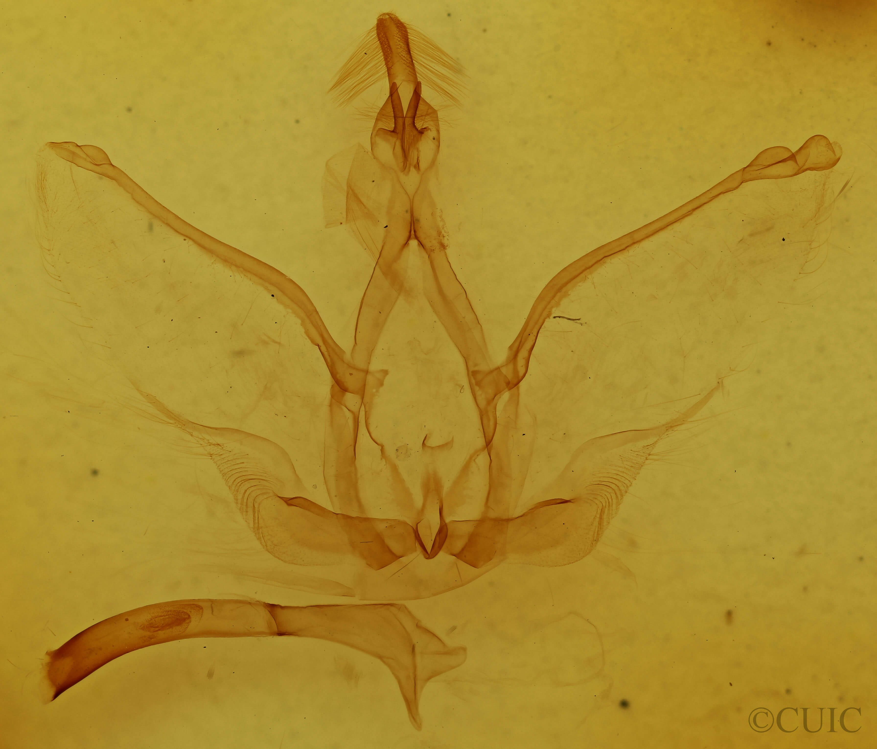 genitalia view of adult Notoplusia marchiana