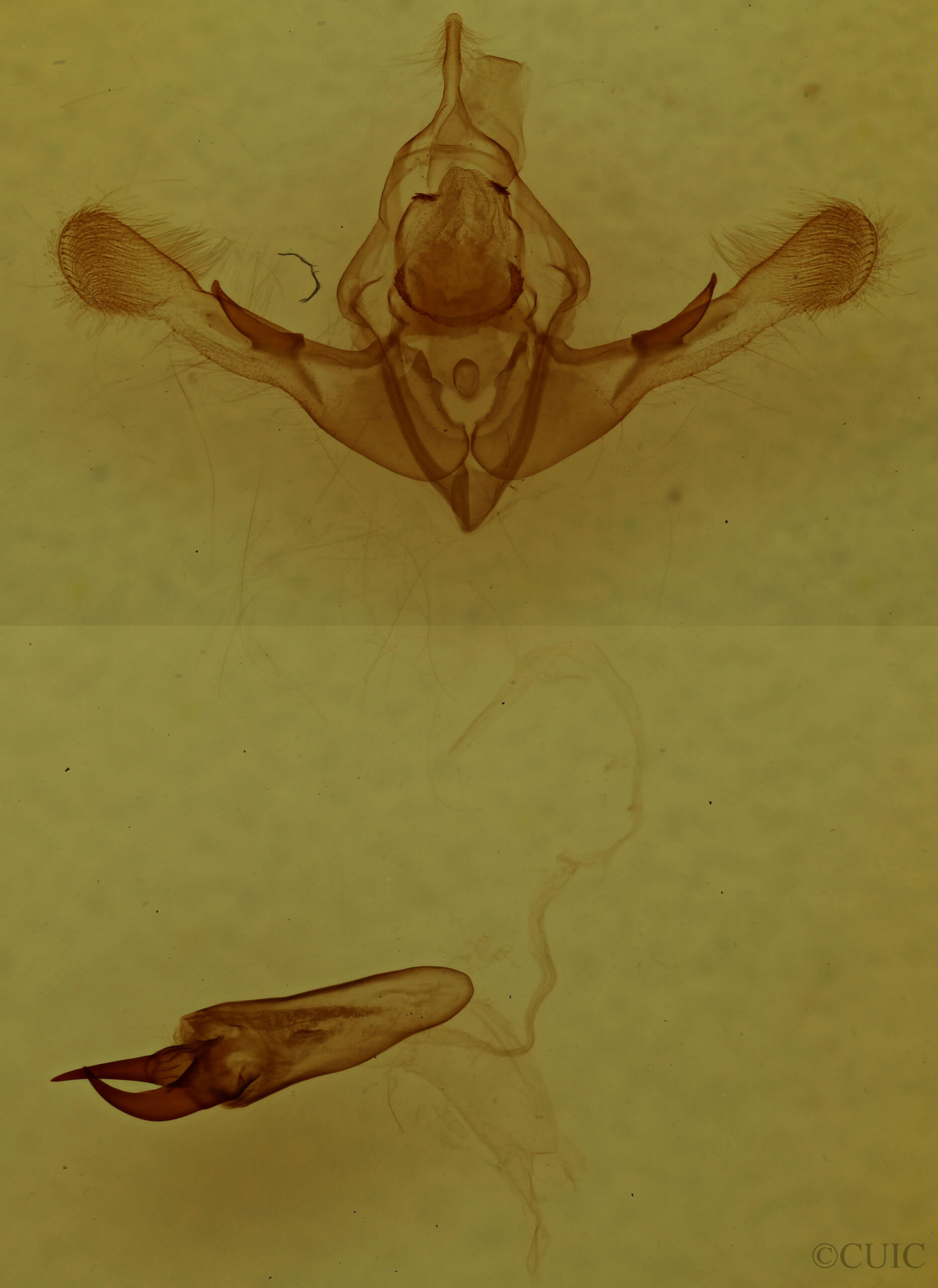 genitalia view of adult Oligia divesta