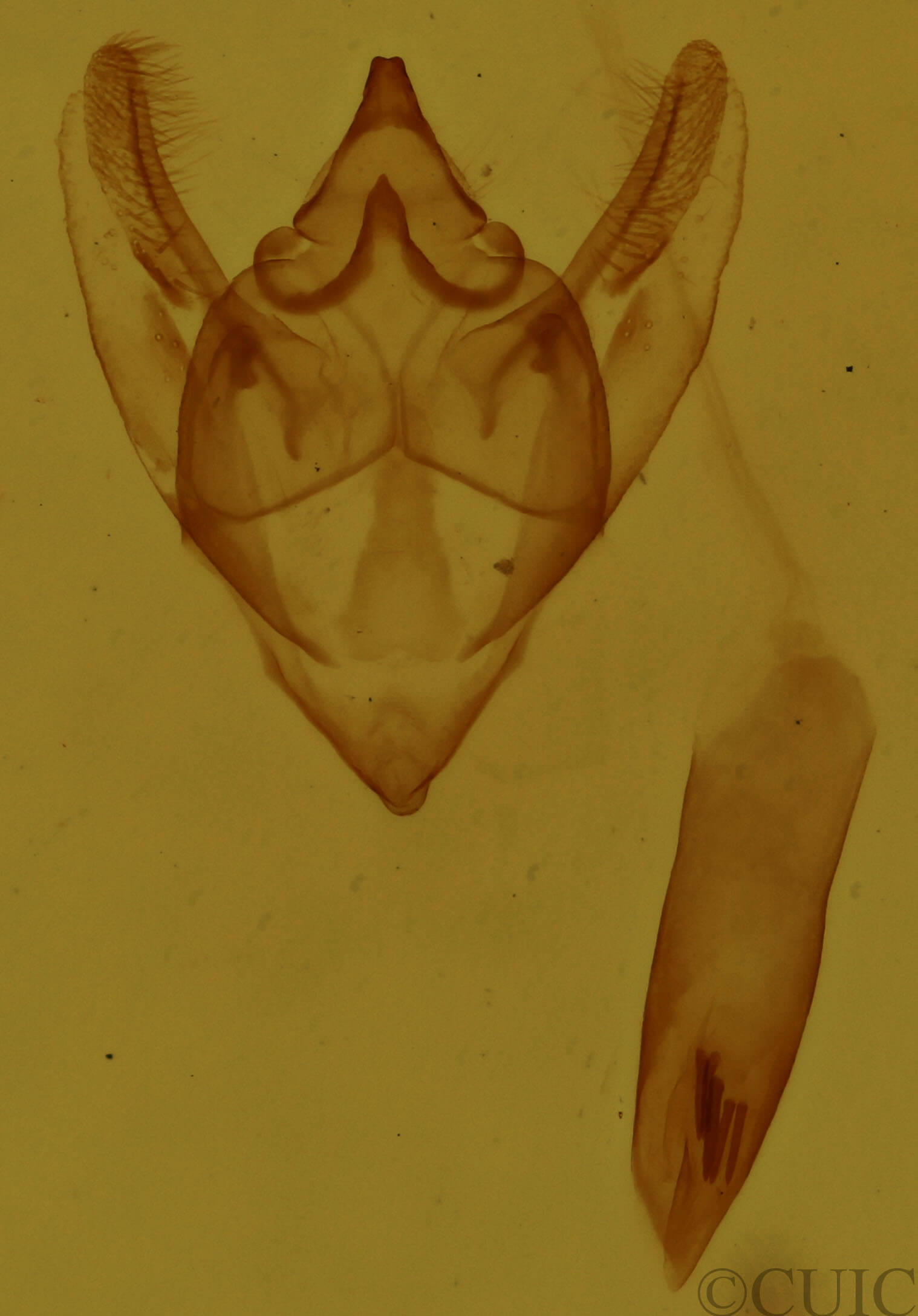 genitalia view of adult Orthofidonia tinctaria