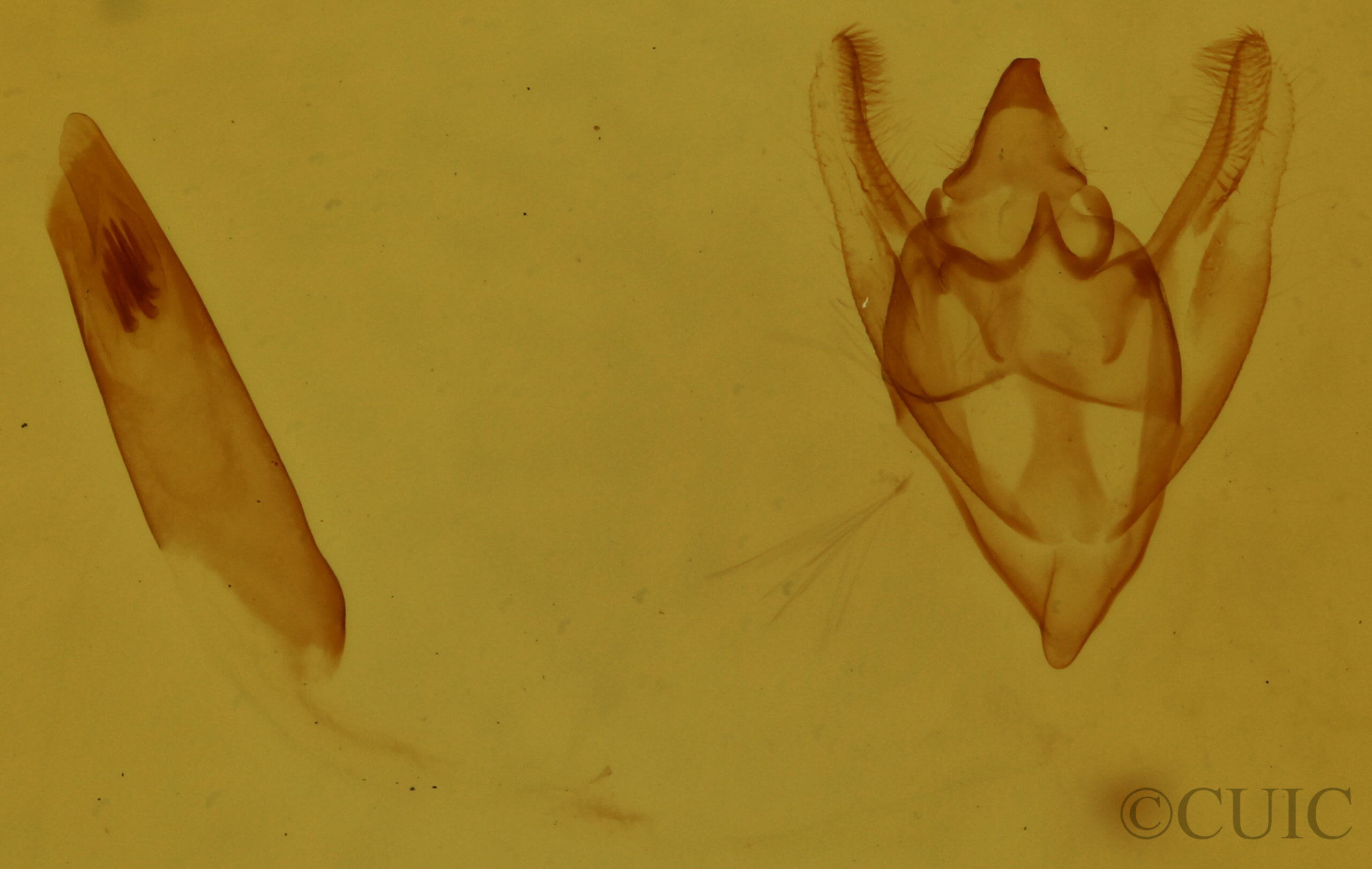genitalia view of adult Orthofidonia tinctaria