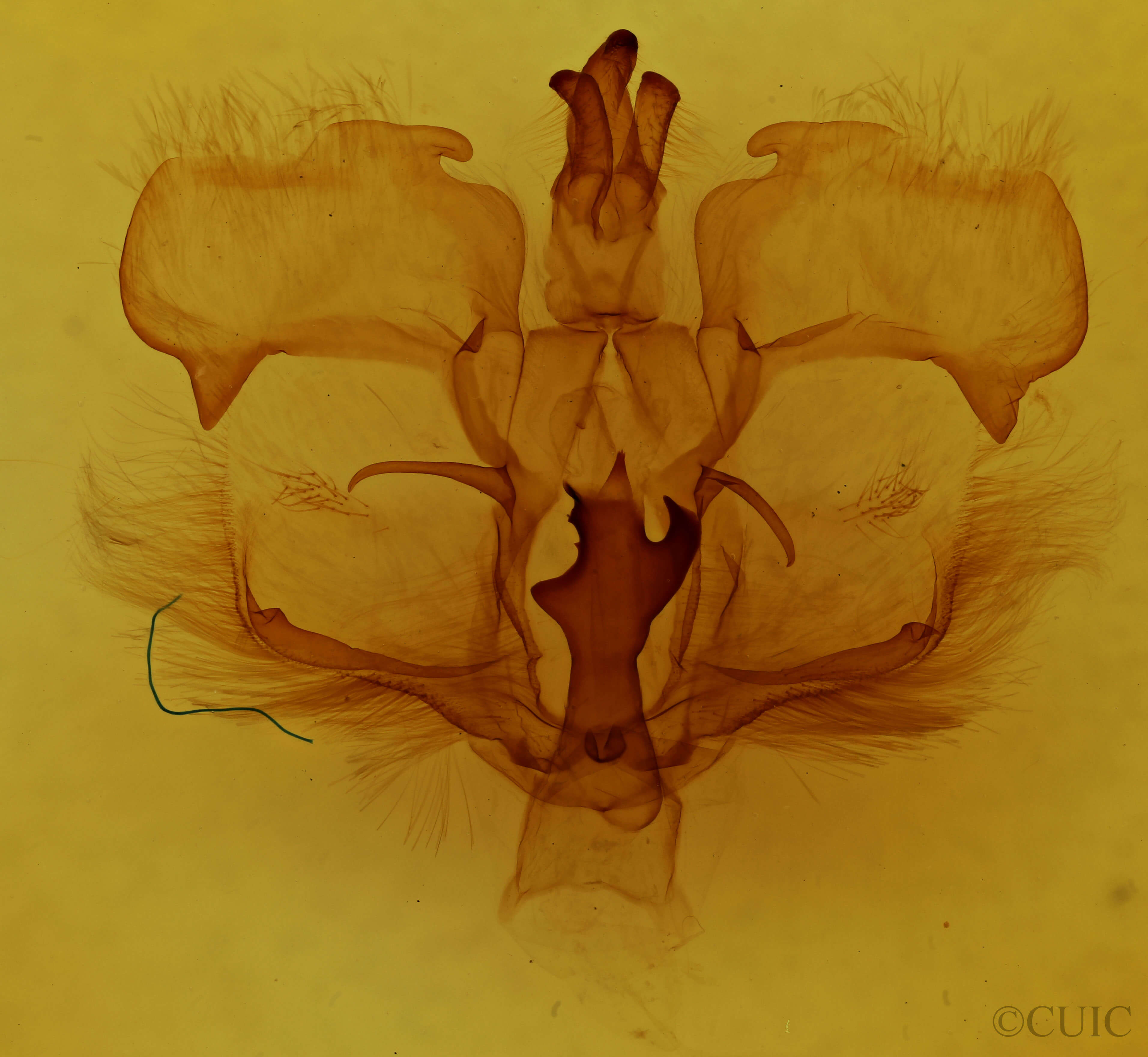 genitalia view of adult Pentobesa