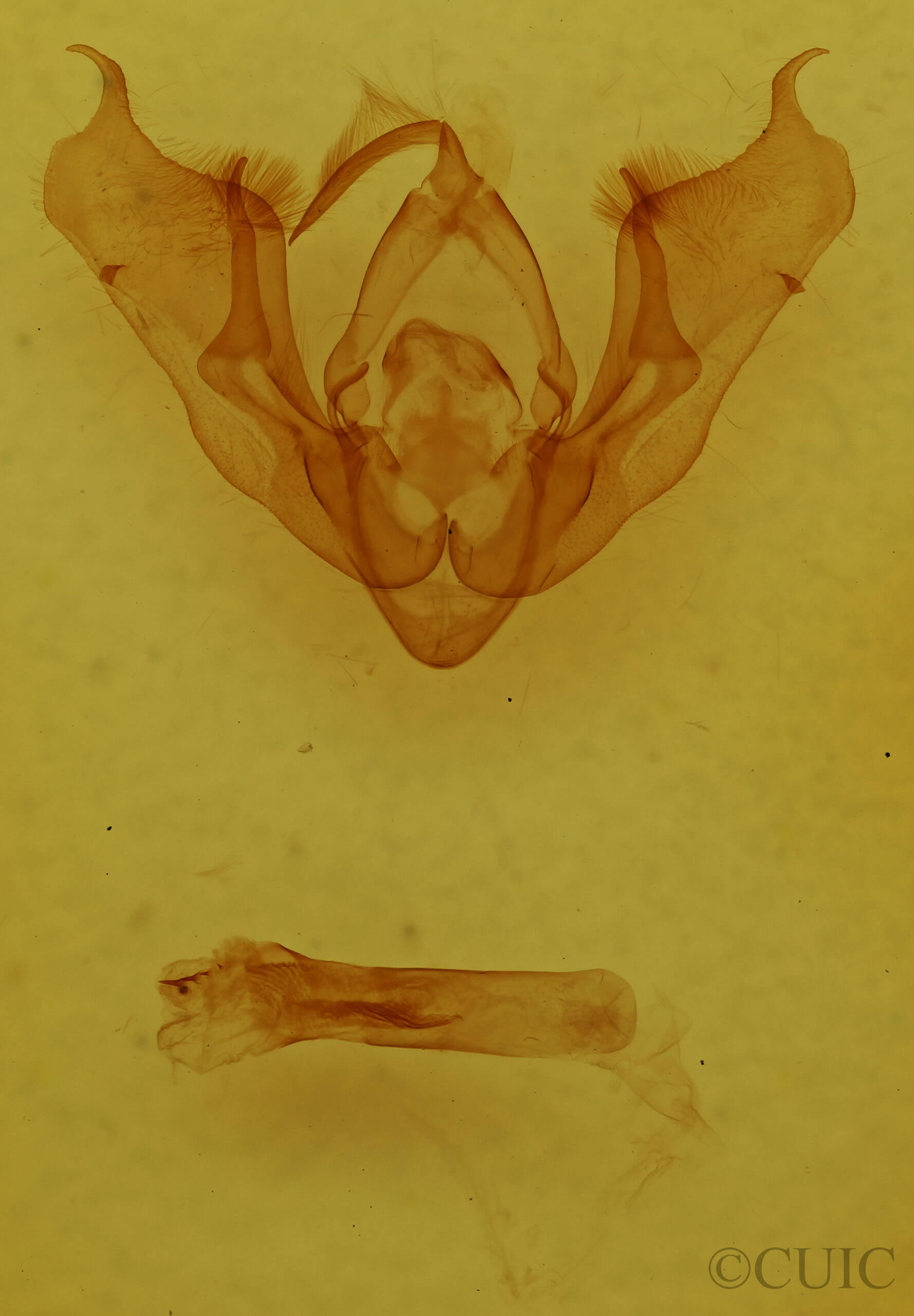 genitalia view of adult Pseudanarta vexata