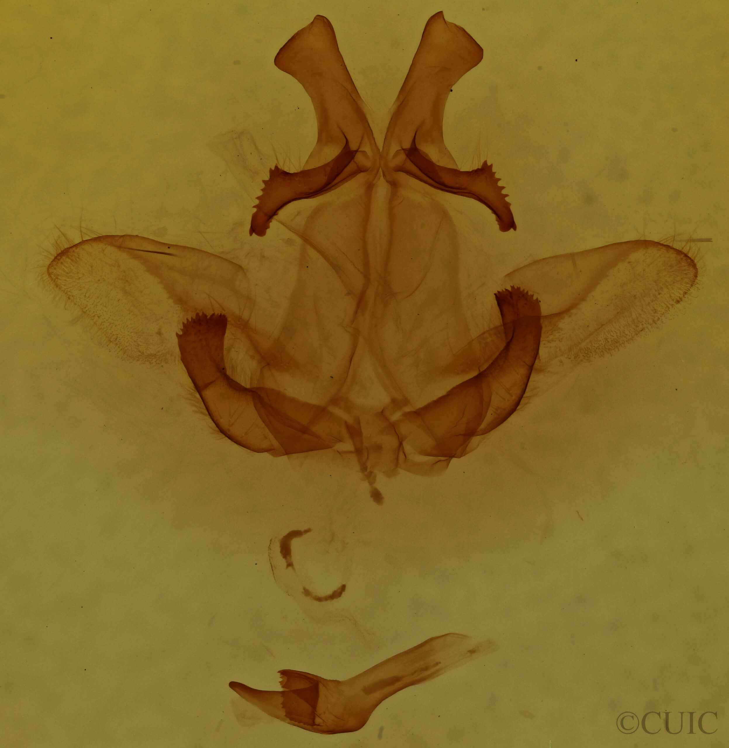 genitalia view of adult Pterostoma palpina