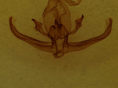 genitalia view of adult Quentalia