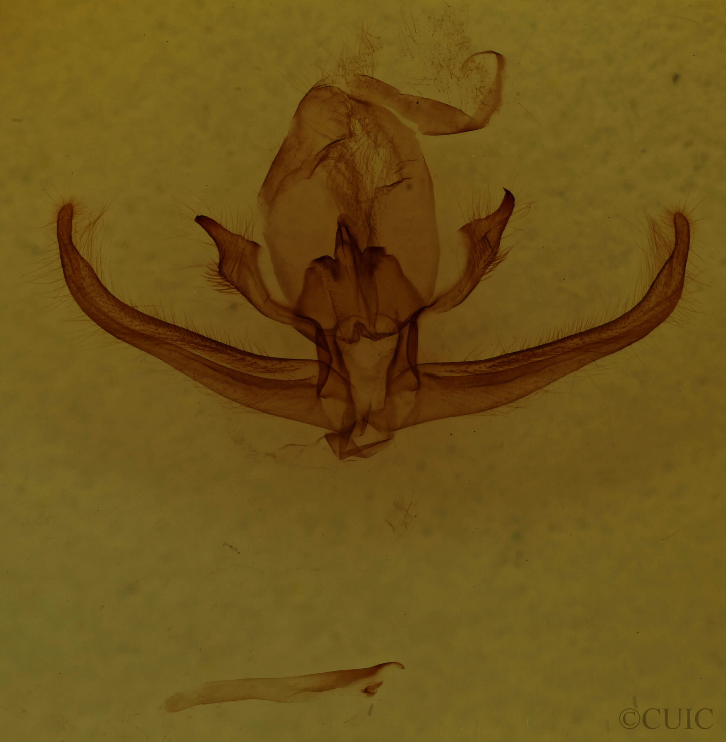 genitalia view of adult Quentalia