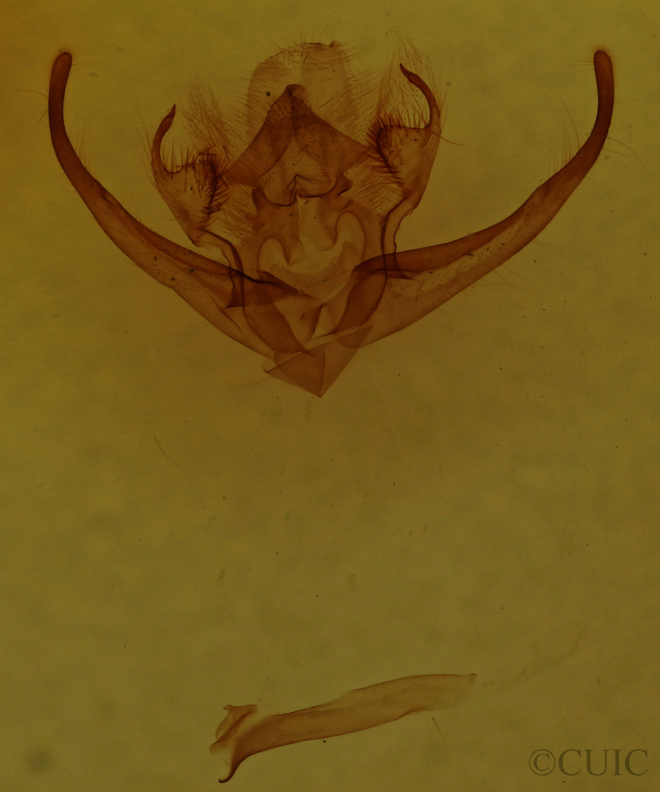 genitalia view of adult Quentalia napima