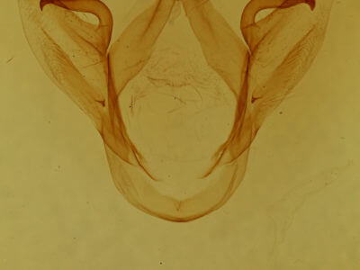 genitalia view of adult Oedemasia leptinoides