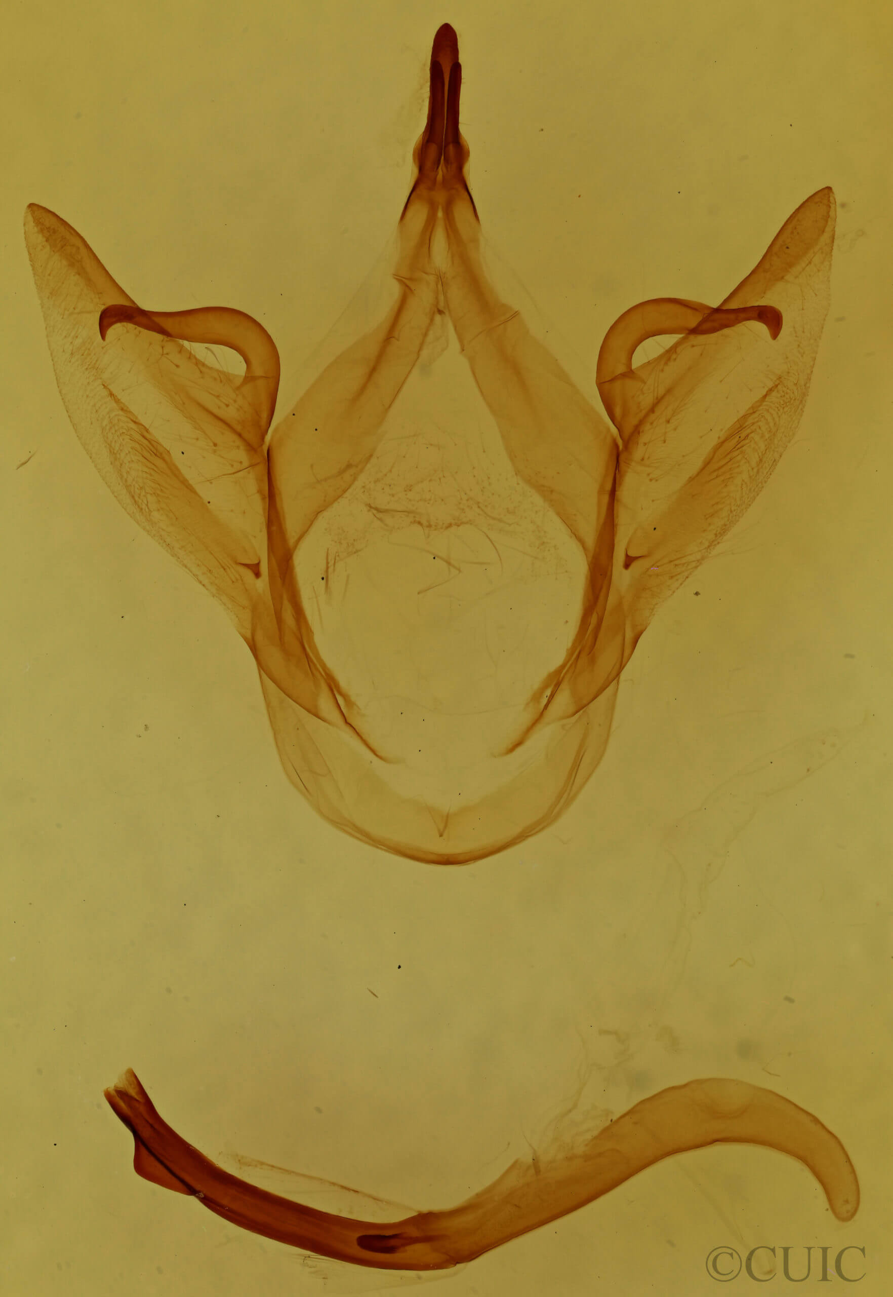 genitalia view of adult Oedemasia leptinoides