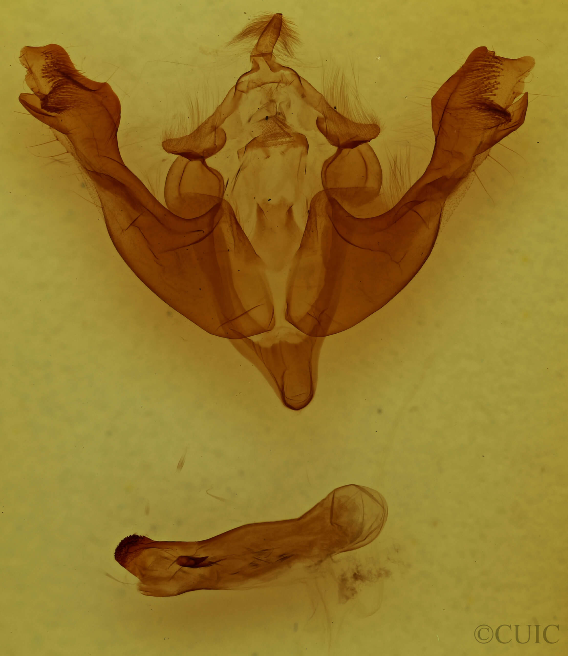 genitalia view of adult Sutyna privata
