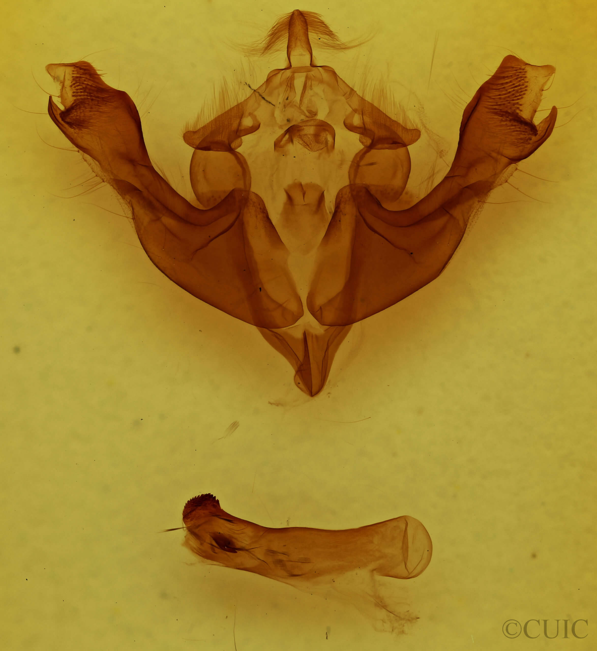genitalia view of adult Sutyna privata