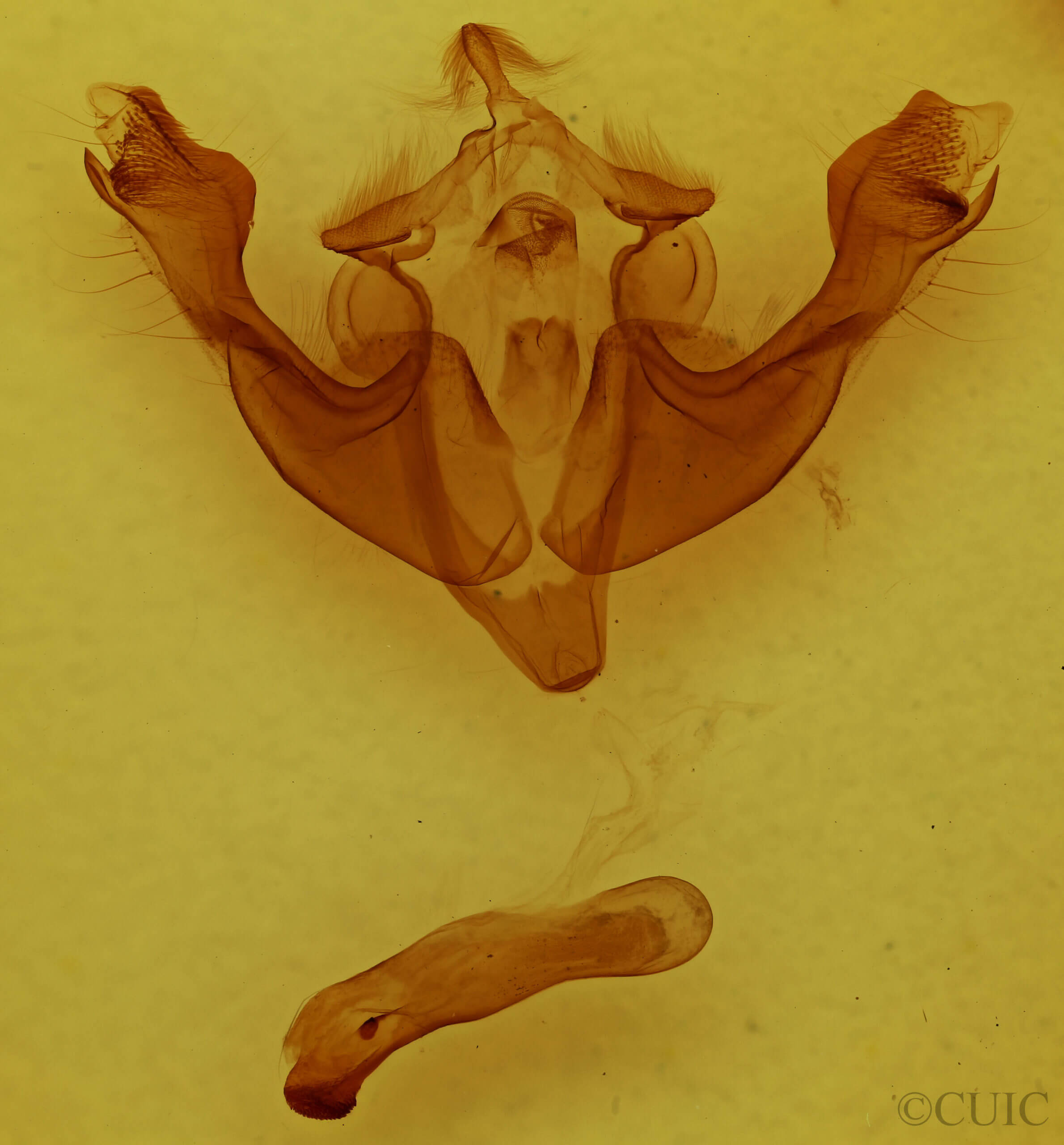 genitalia view of adult Sutyna privata