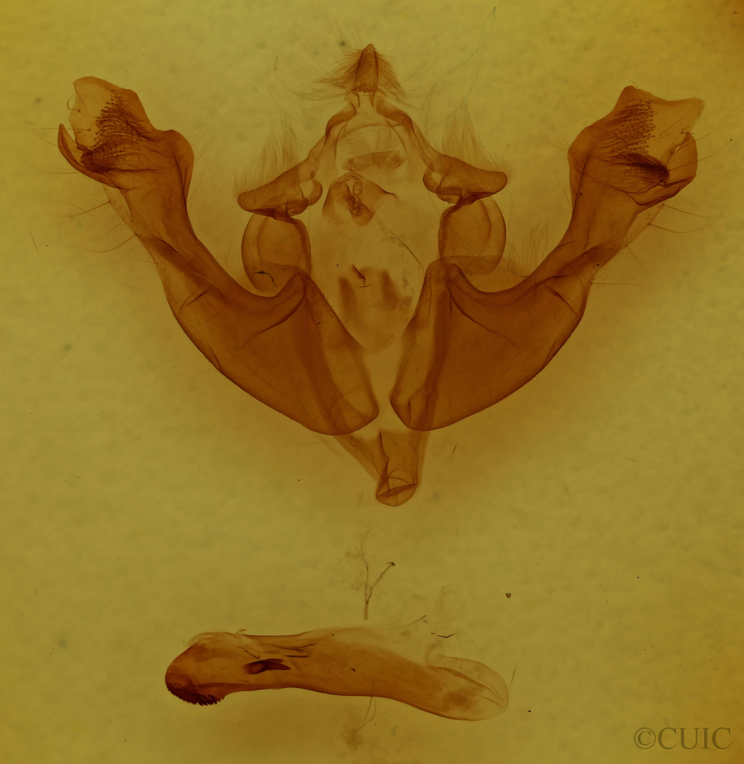 genitalia view of adult Sutyna privata