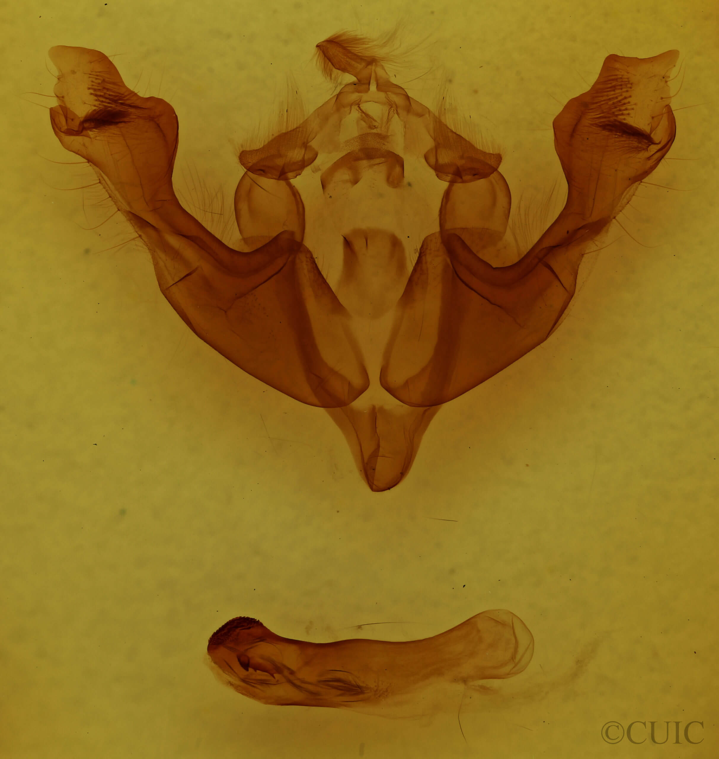 genitalia view of adult Sutyna privata