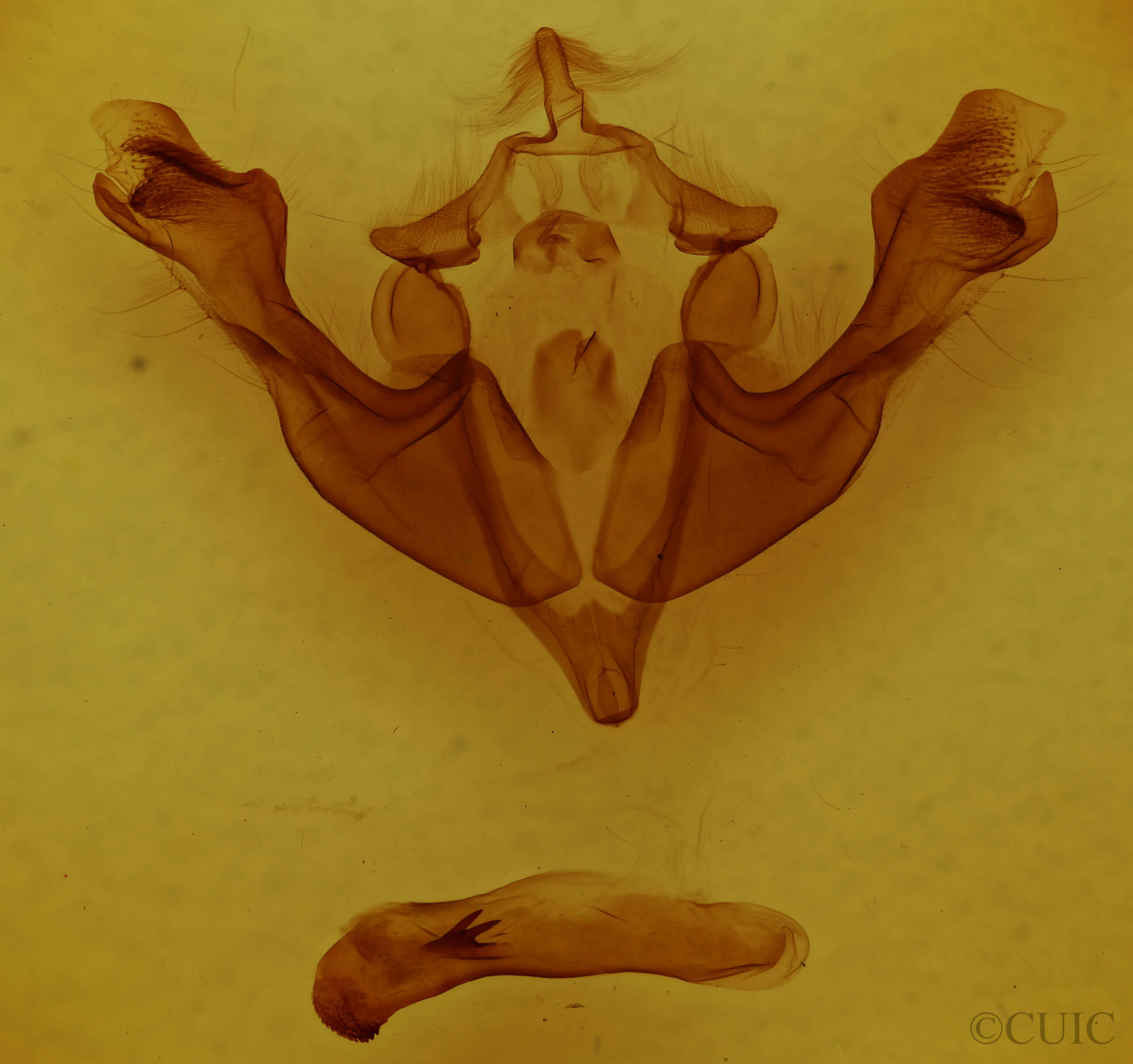 genitalia view of adult Sutyna privata