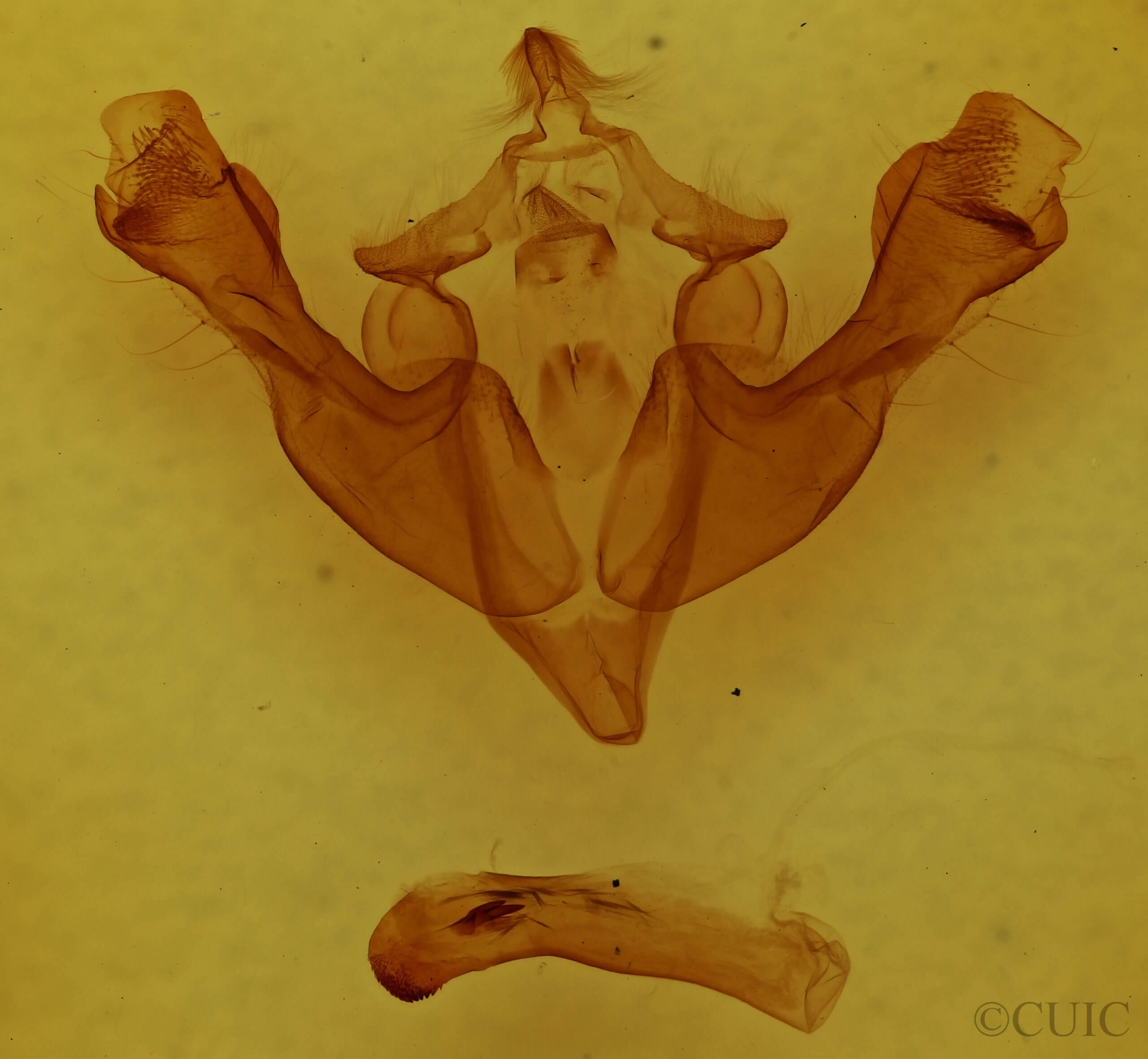 genitalia view of adult Sutyna privata