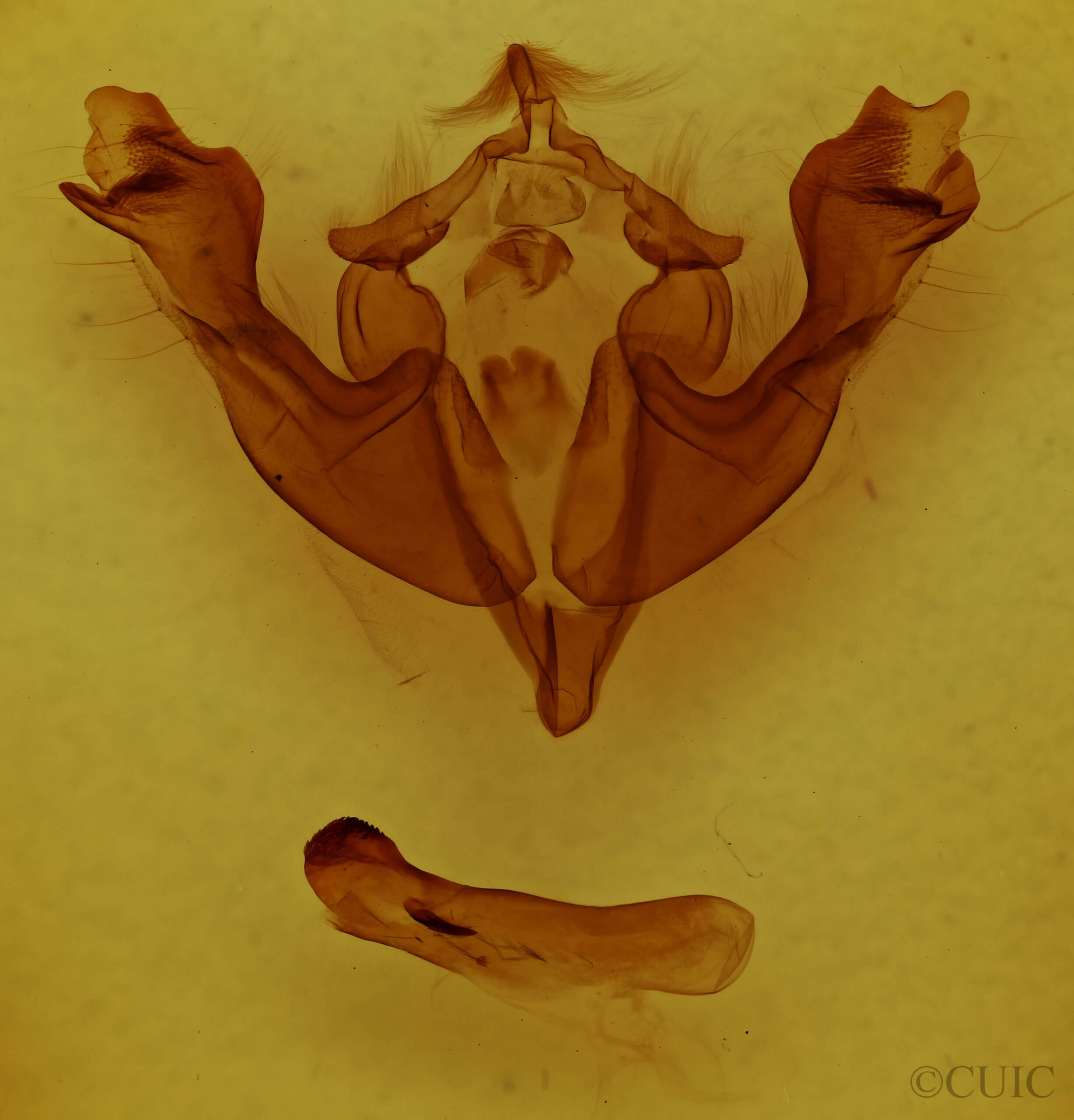 genitalia view of adult Sutyna privata