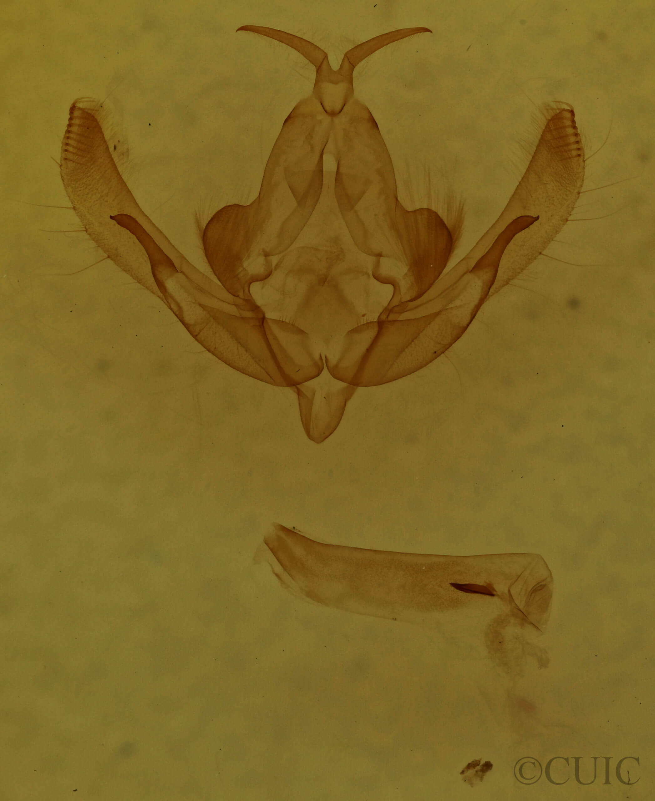 genitalia view of adult Xanthia togata