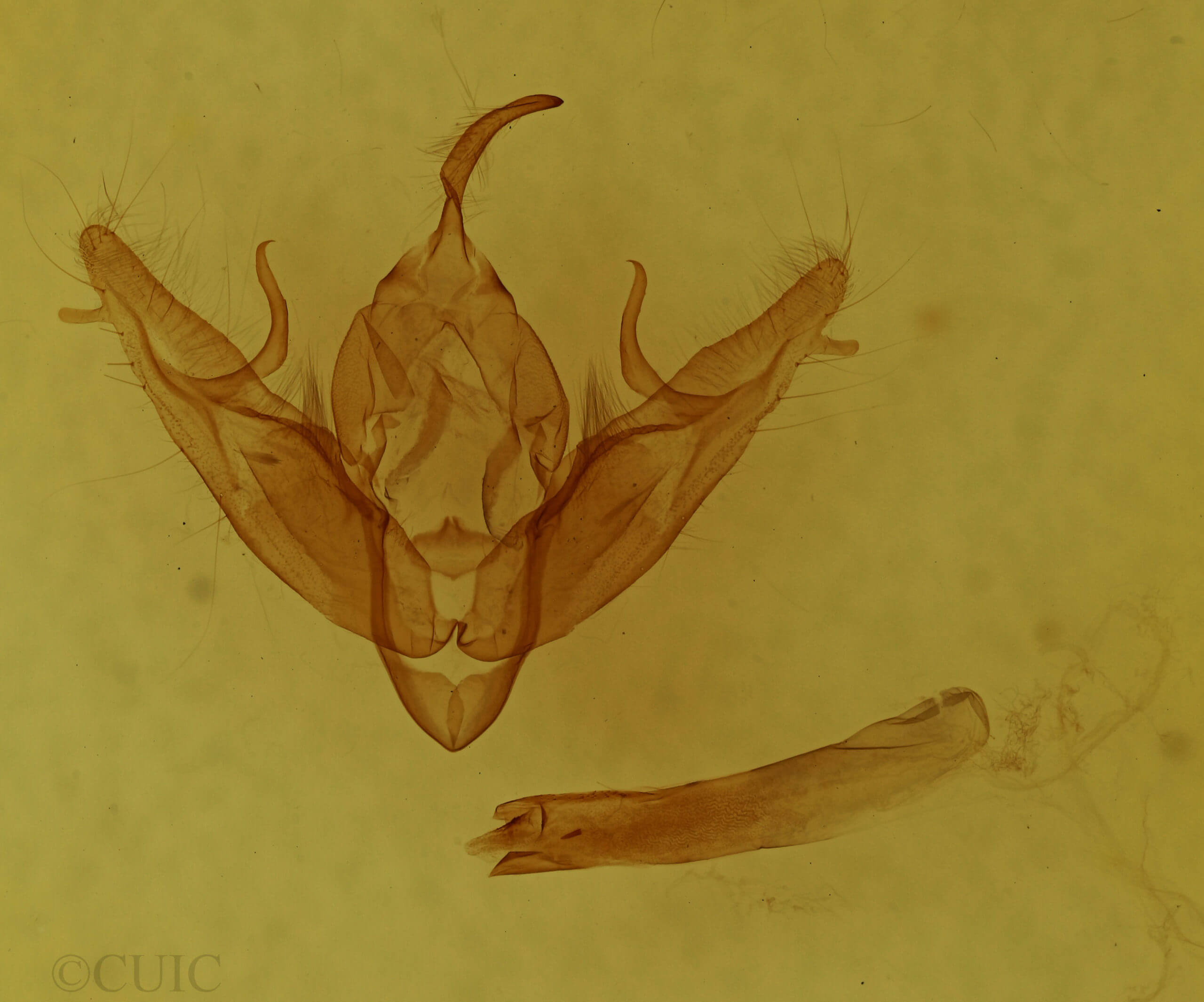 genitalia view of adult Xestia dilucida