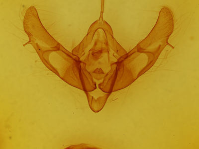genitalia view of adult Xestia stupenda
